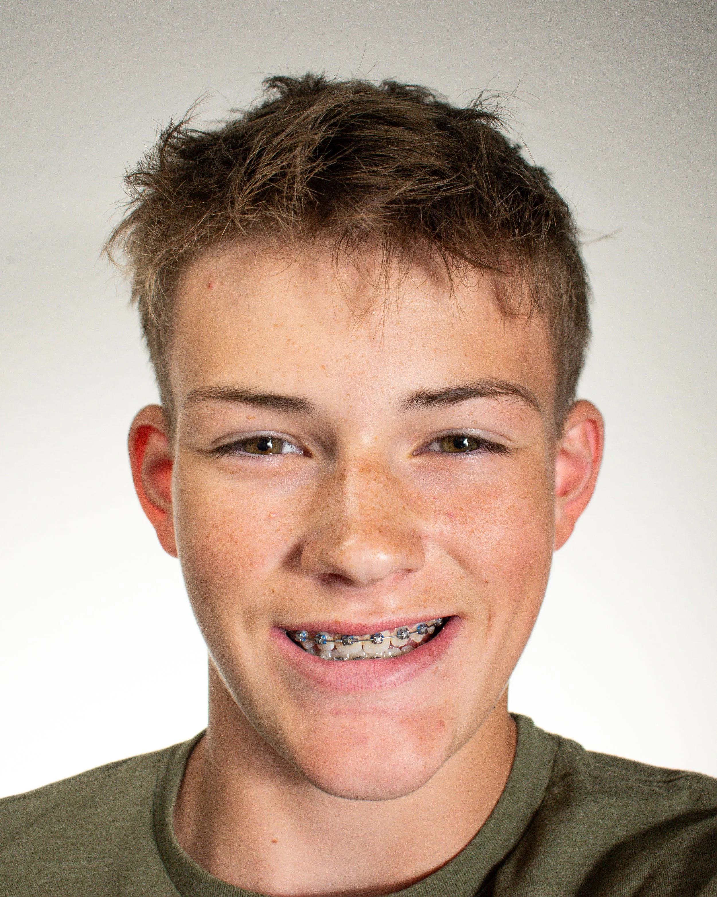 Close-up of a smiling young person with braces, freckles, and short brown hair, wearing an olive green shirt.