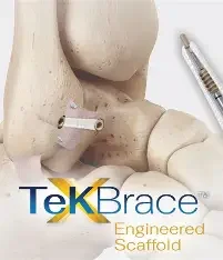 An anatomical model of a knee with a TeKBrace engineered scaffold label, and a syringe placed nearby.