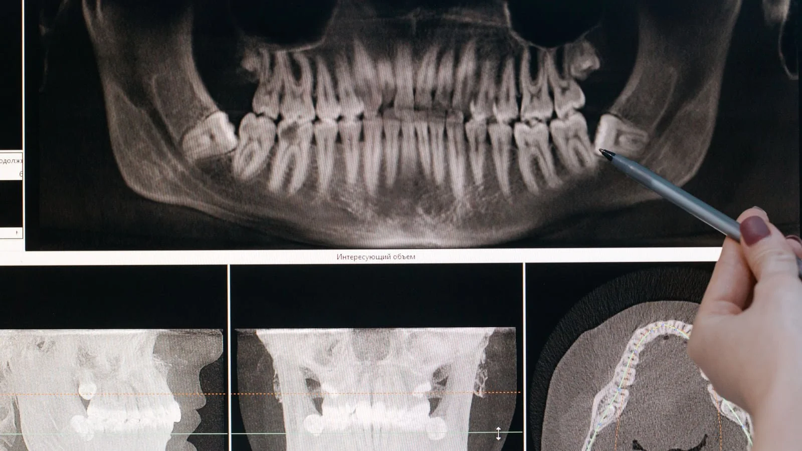 Root Cavities