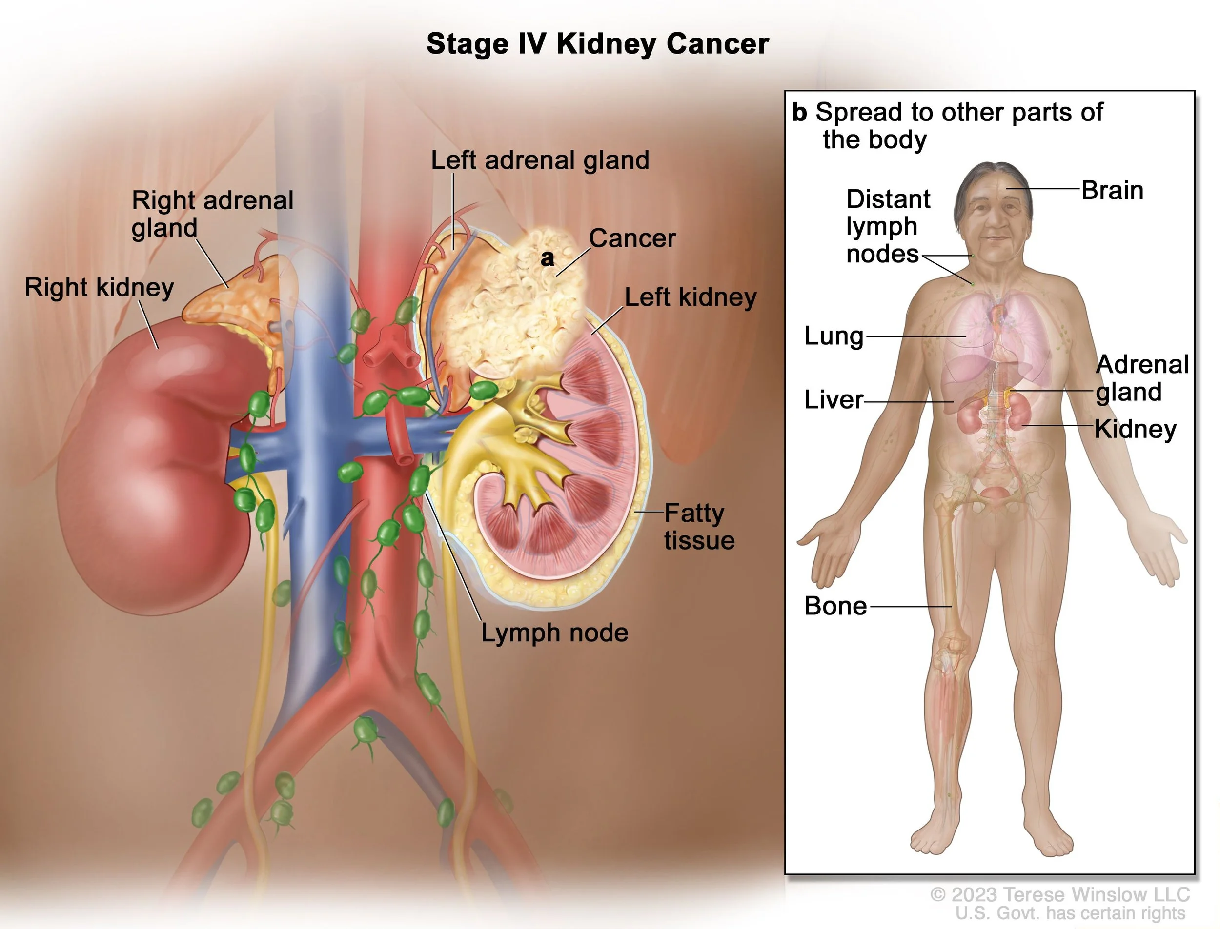 What Does My Treatment Look Like?