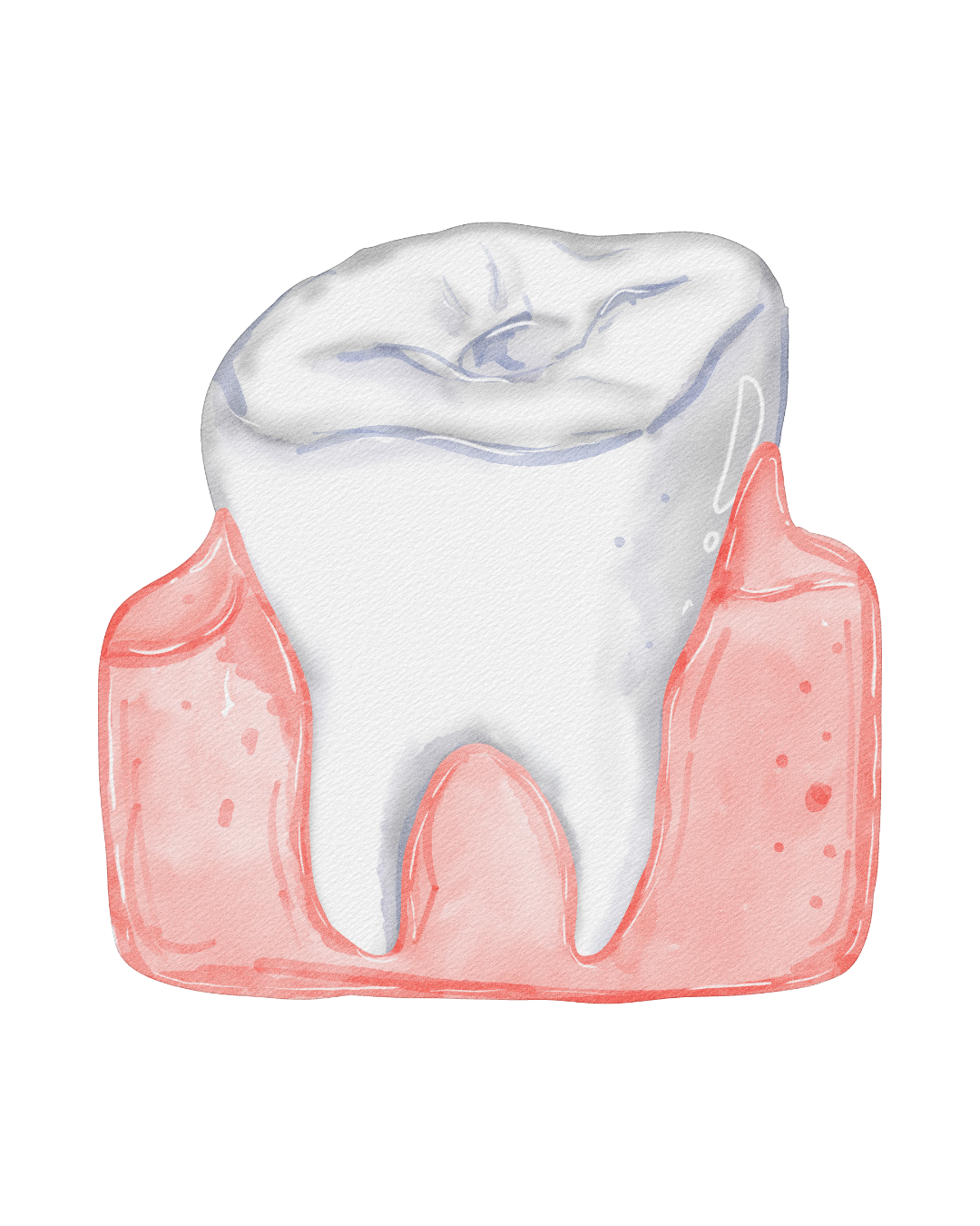 Illustration representing gum and periodontal care at Fort Dental Clinic.