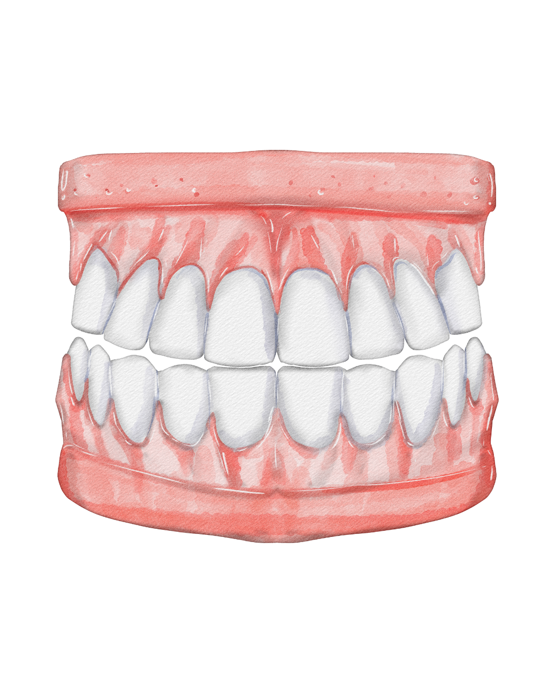 Illustration representing dentures and tooth replacement at Fort Dental Clinic.