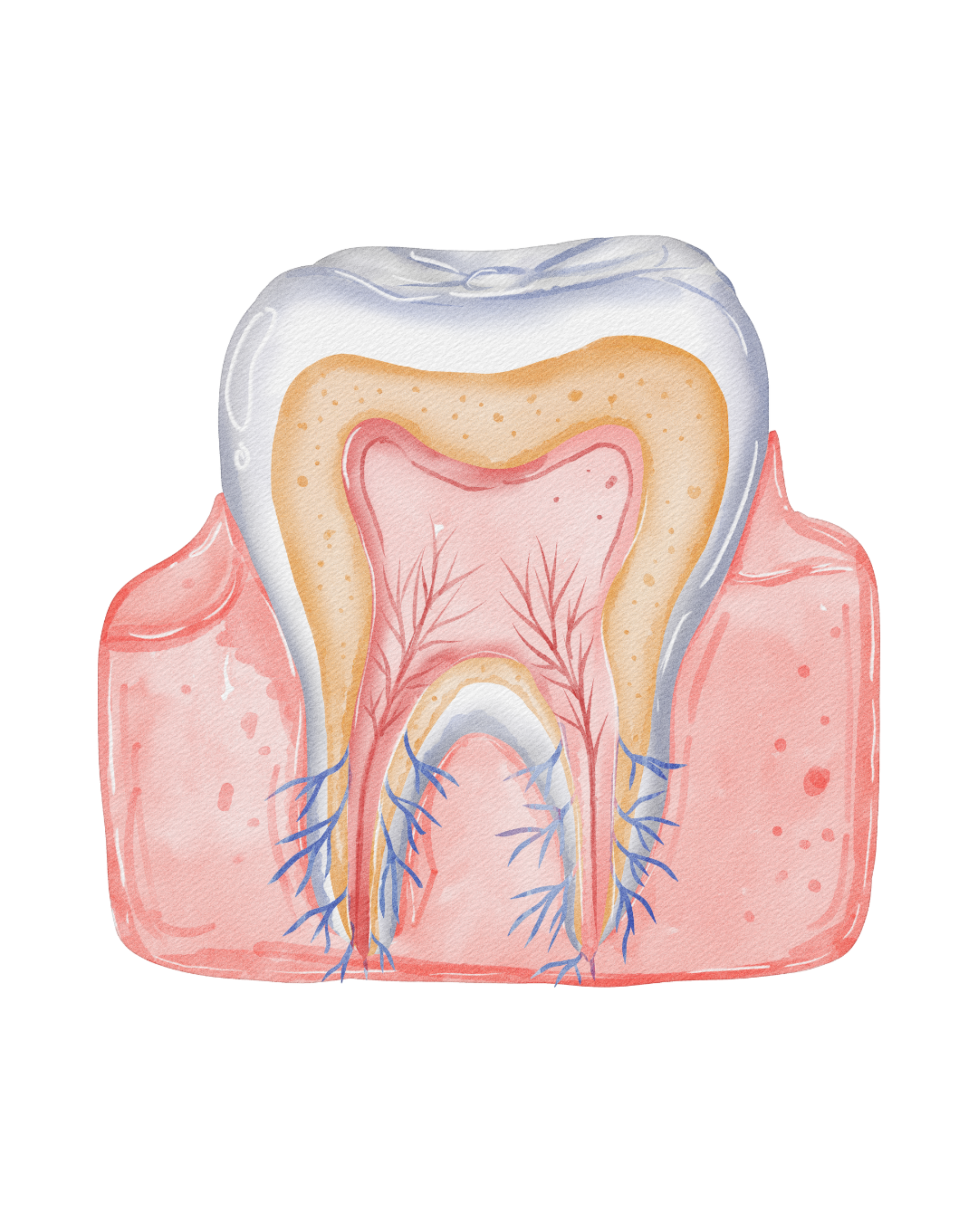 Illustration representing root canal therapy at Fort Dental Clinic.