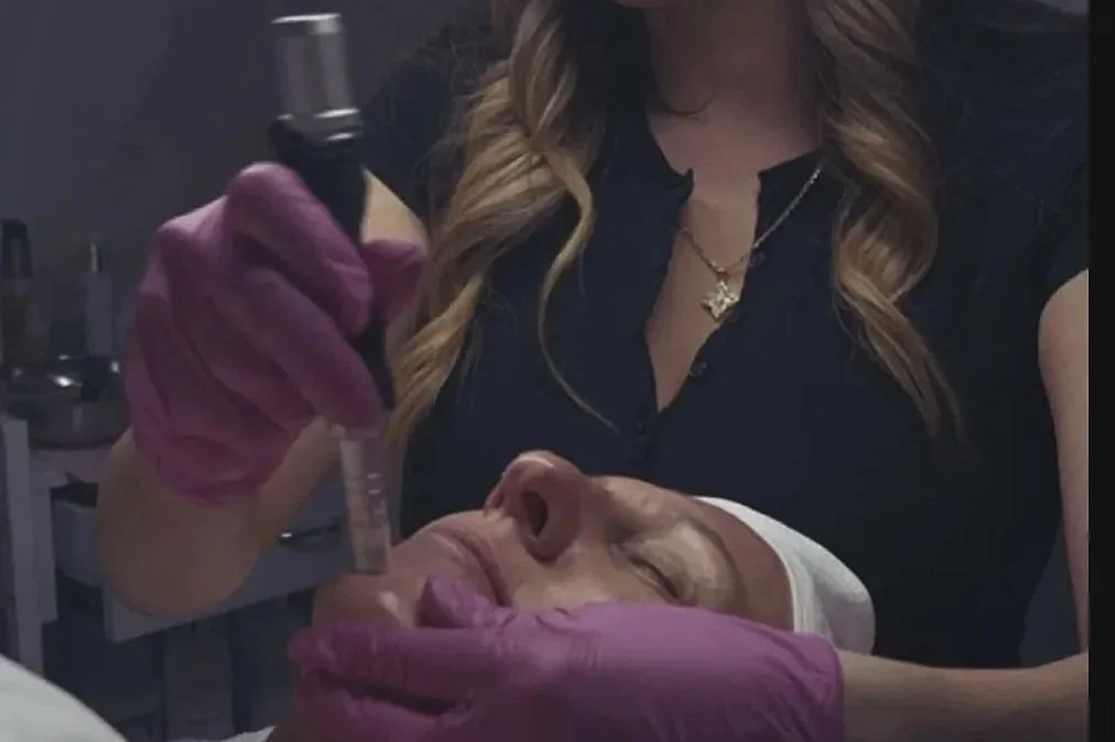 Microneedling vs. Chemical Peels: Which Is Better for Your Skin?