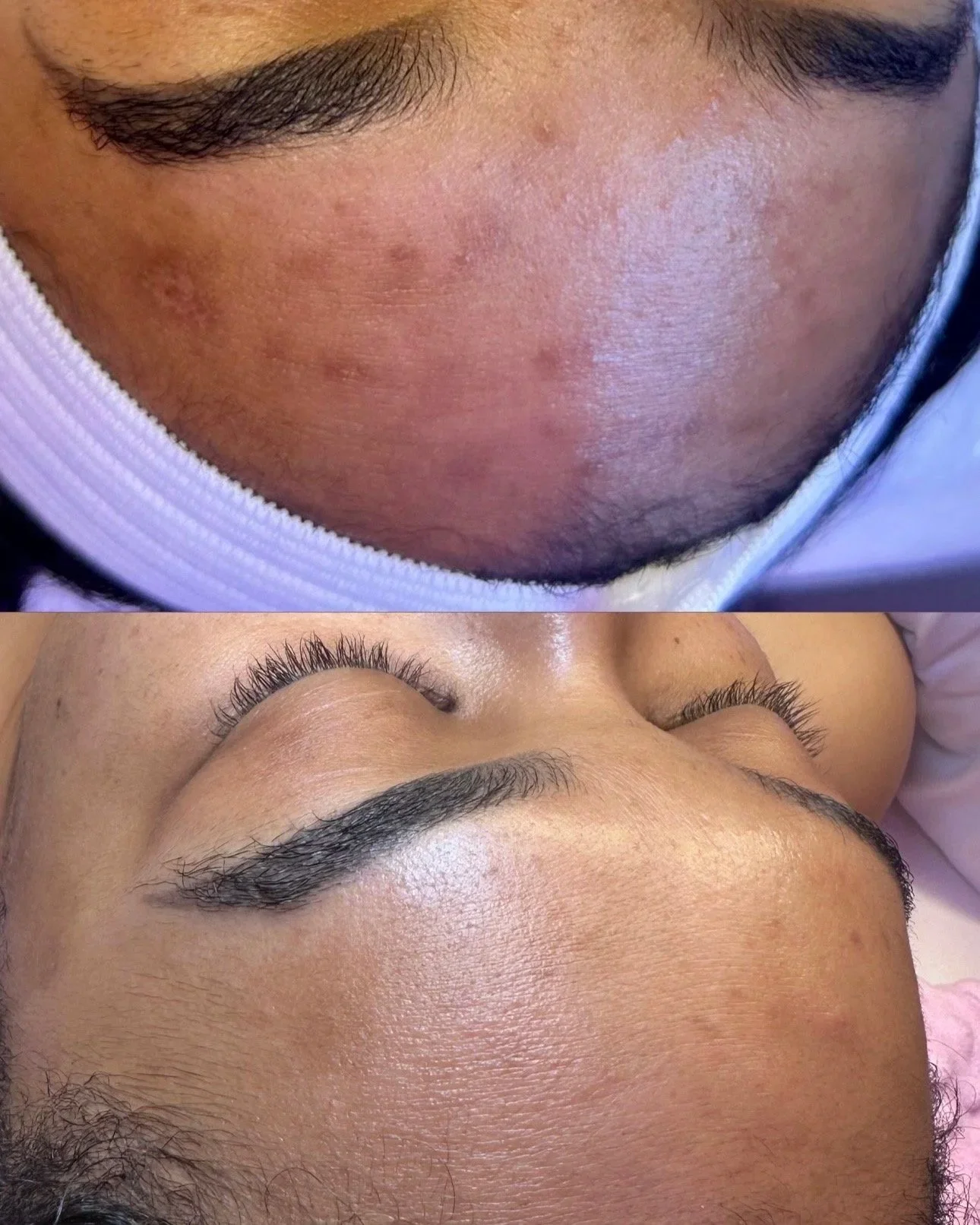 Close-up of a person's face before and after eyelash extensions, showing smooth skin and well-groomed eyebrows.