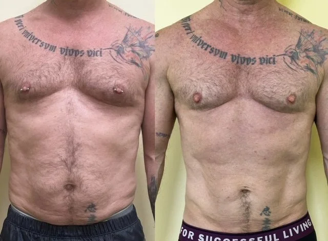Hombre desnudo frente a un fondo amarillo, con tatuajes en el pecho y abdomen, mostranda antes y después de una transformación física, con una camiseta negra con letras blancas en la segunda imagen.