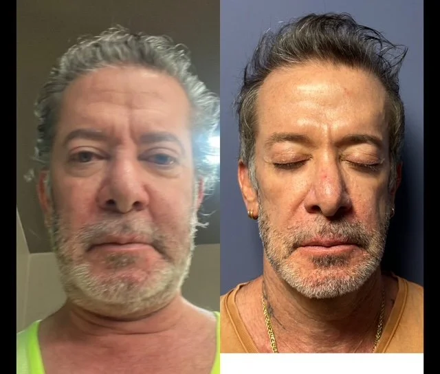 Imagen dividida en dos partes mostrando al mismo hombre con diferentes estilos de cabello y expresión facial.