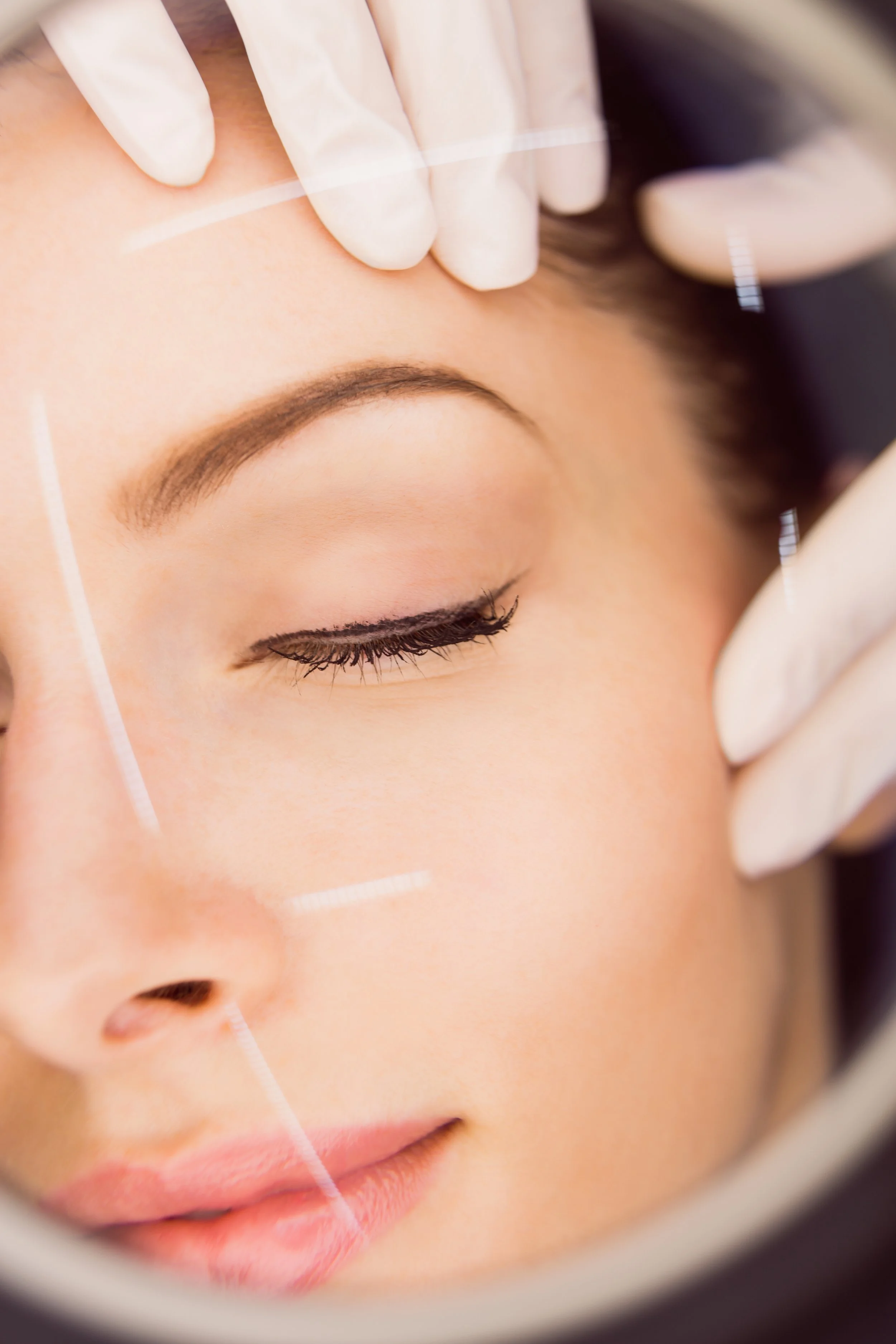 Procedimiento de cirugia de ojos con marcas en la piel y gloved manos manipulando el rostro de una persona, en un entorno médico.