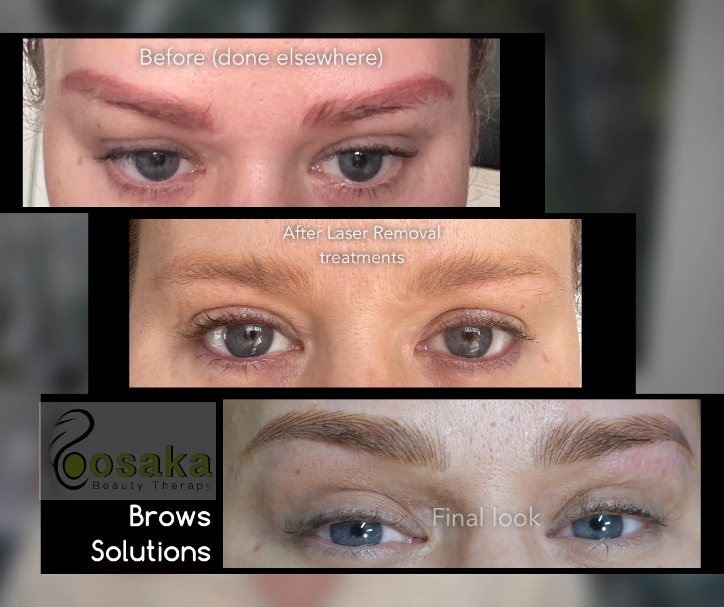 BROWS FIXING SOLUTIONS (for old brows tattoo)