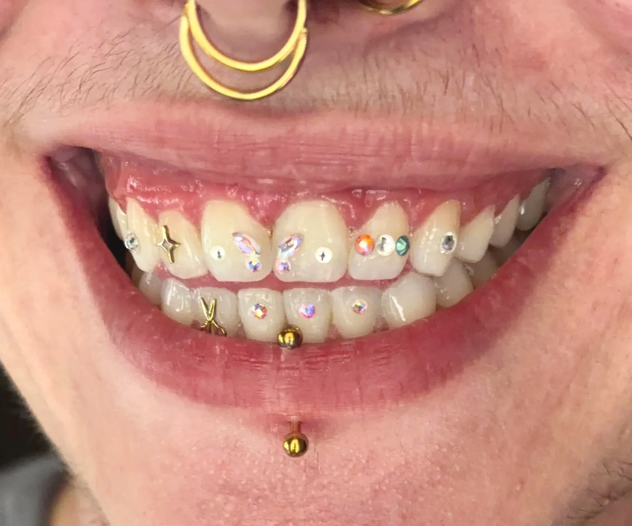 Freestyle smile