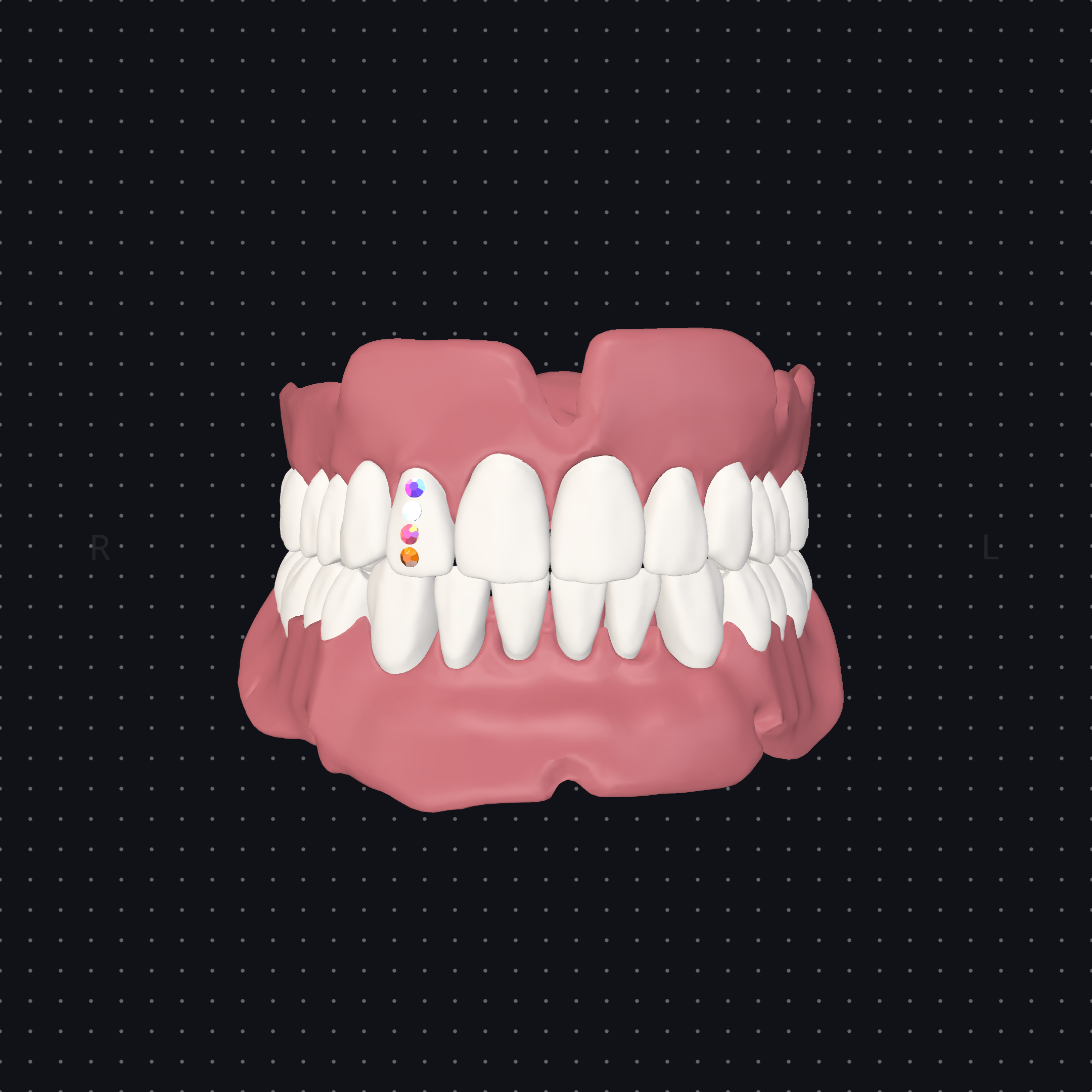 Quad Stack (Color)