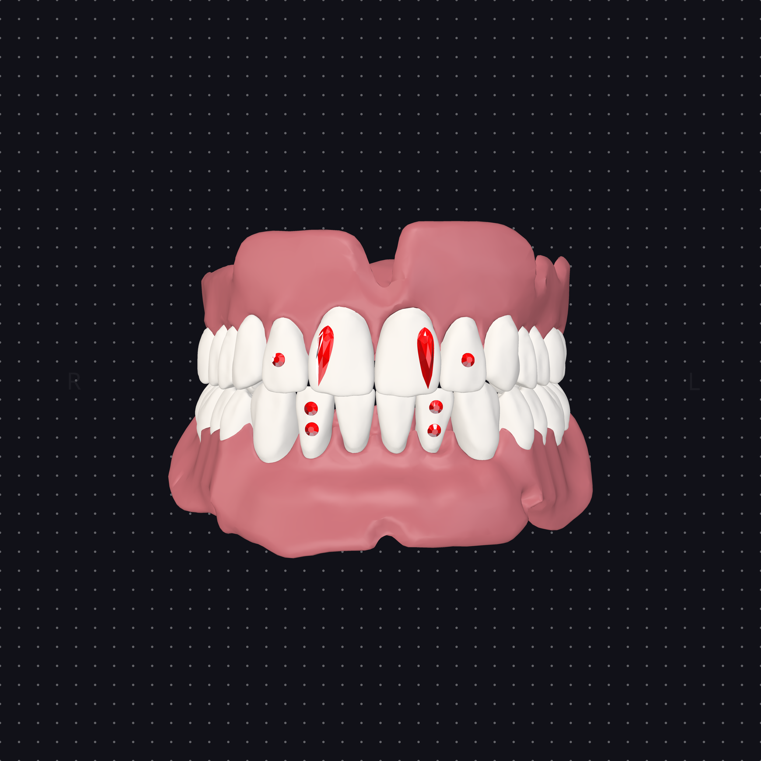 Vampire Bites - $85