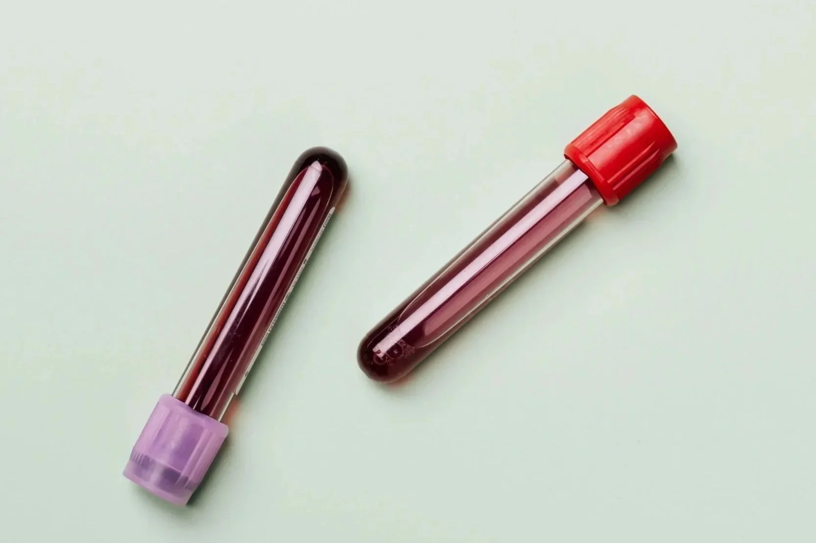 Zwei Blutproben in klaren Röhrchen mit rot-rosa Inhalt, eines mit lila Deckel, auf hellem, einfarbigem Hintergrund