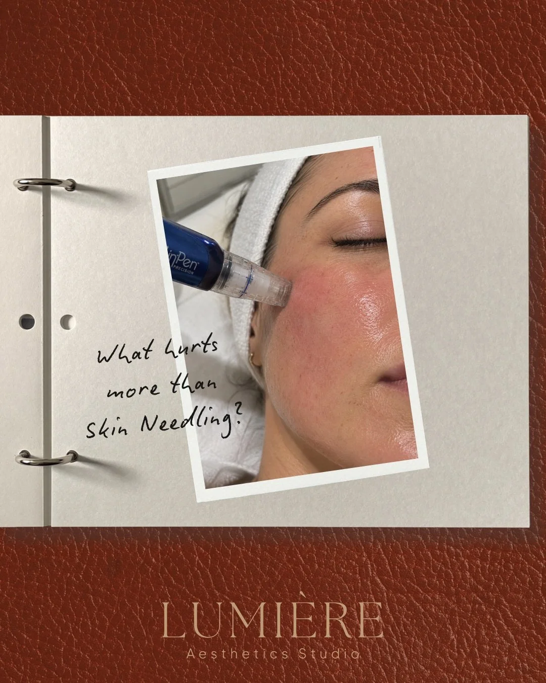 Some things hurt more than skin needling&hellip; 🤭🤎

Like being left on read, accidentally liking a insta photo from 2006, or waving back at someone who definitely wasn&rsquo;t waving at you. We&rsquo;ve all been there. 😂

But seriously, if the th