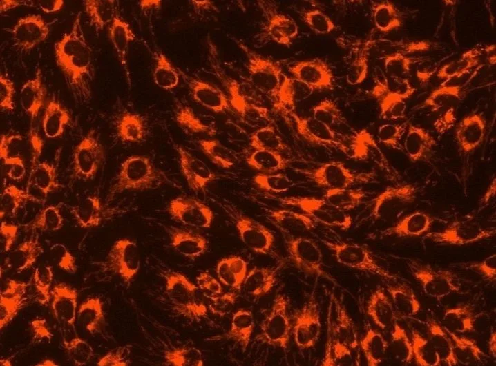 Fluorescence microscopy demonstrating mitochondrial architecture and cellular bioenergetics in glioblastoma research.
