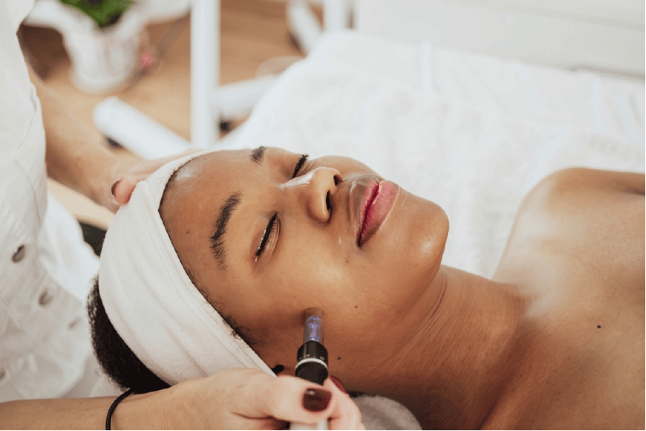 Microneedling