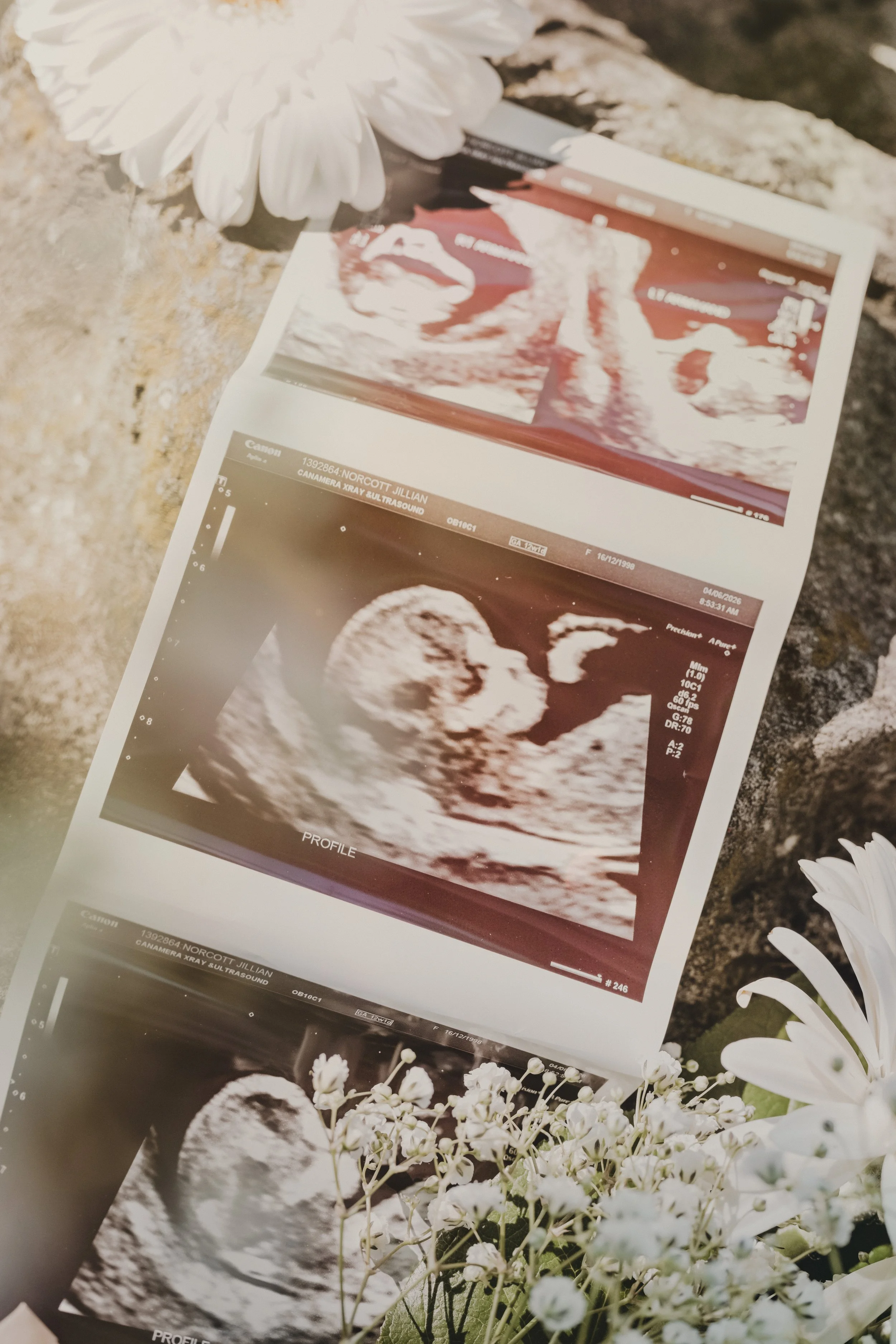 Jill + Gurvir Announcement (198).jpg