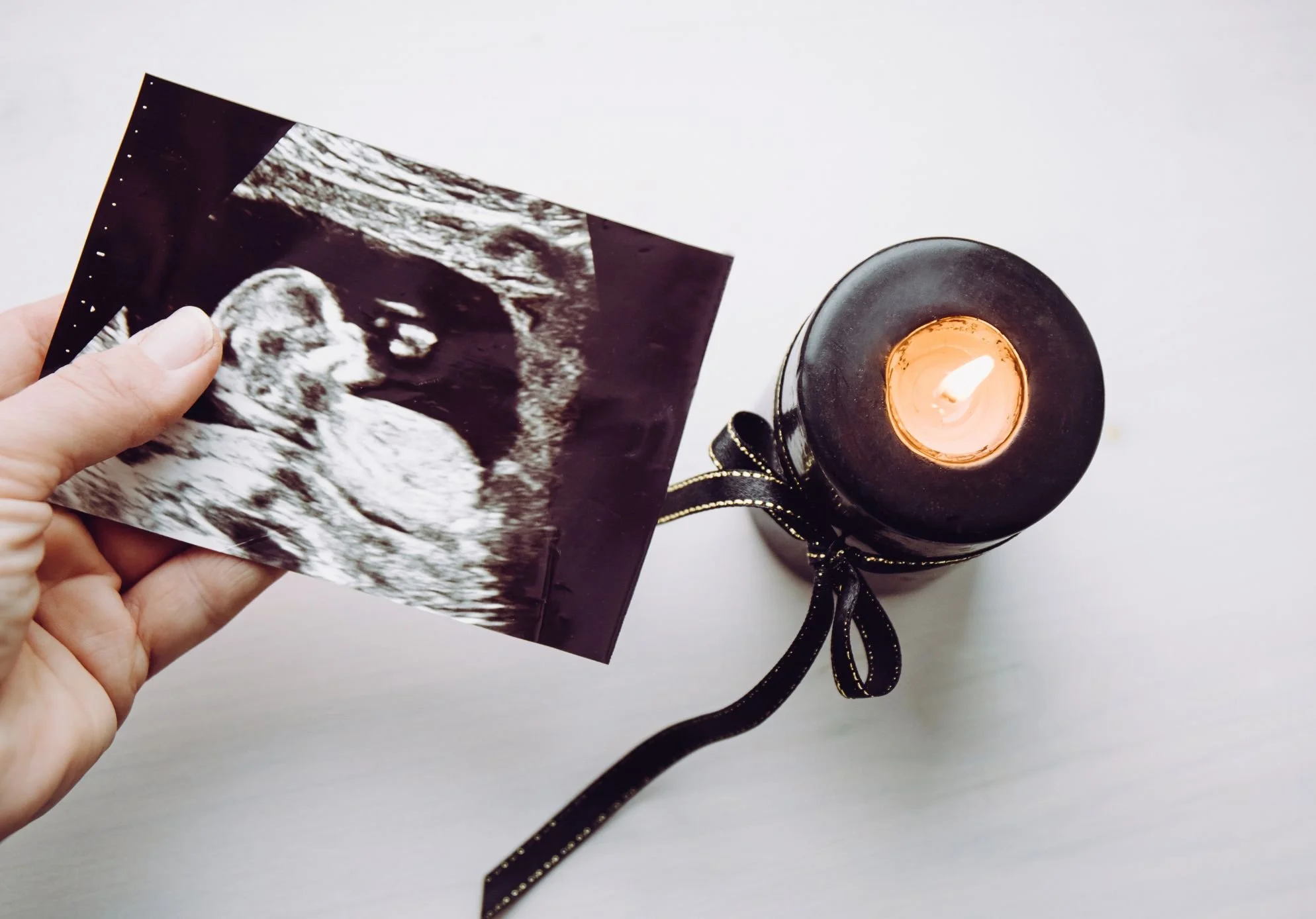 Navigating the Grief of Pregnancy and Infant Loss