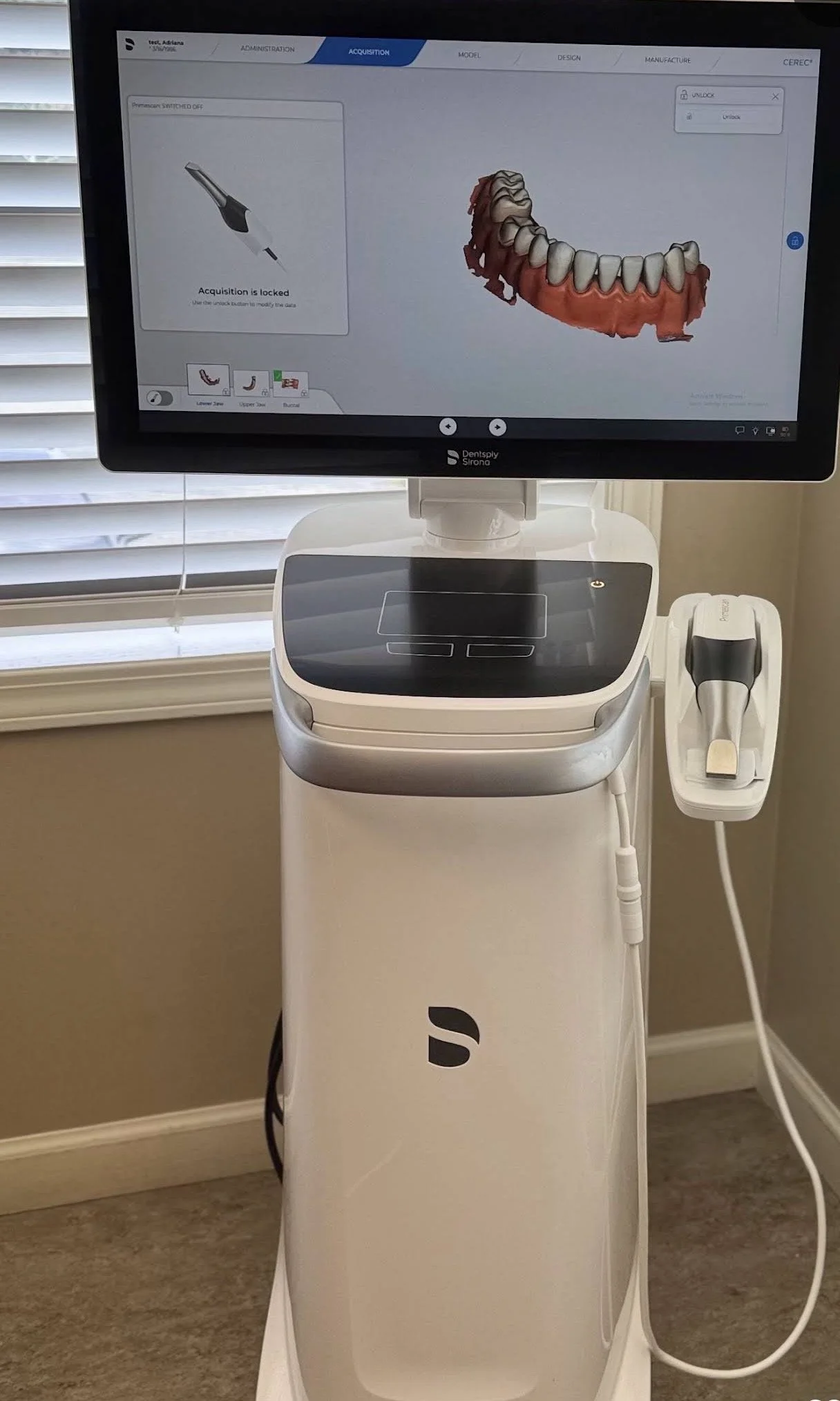 A dental 3D imaging machine with a screen showing a digital model of a set of teeth and gums, positioned near a window with blinds.