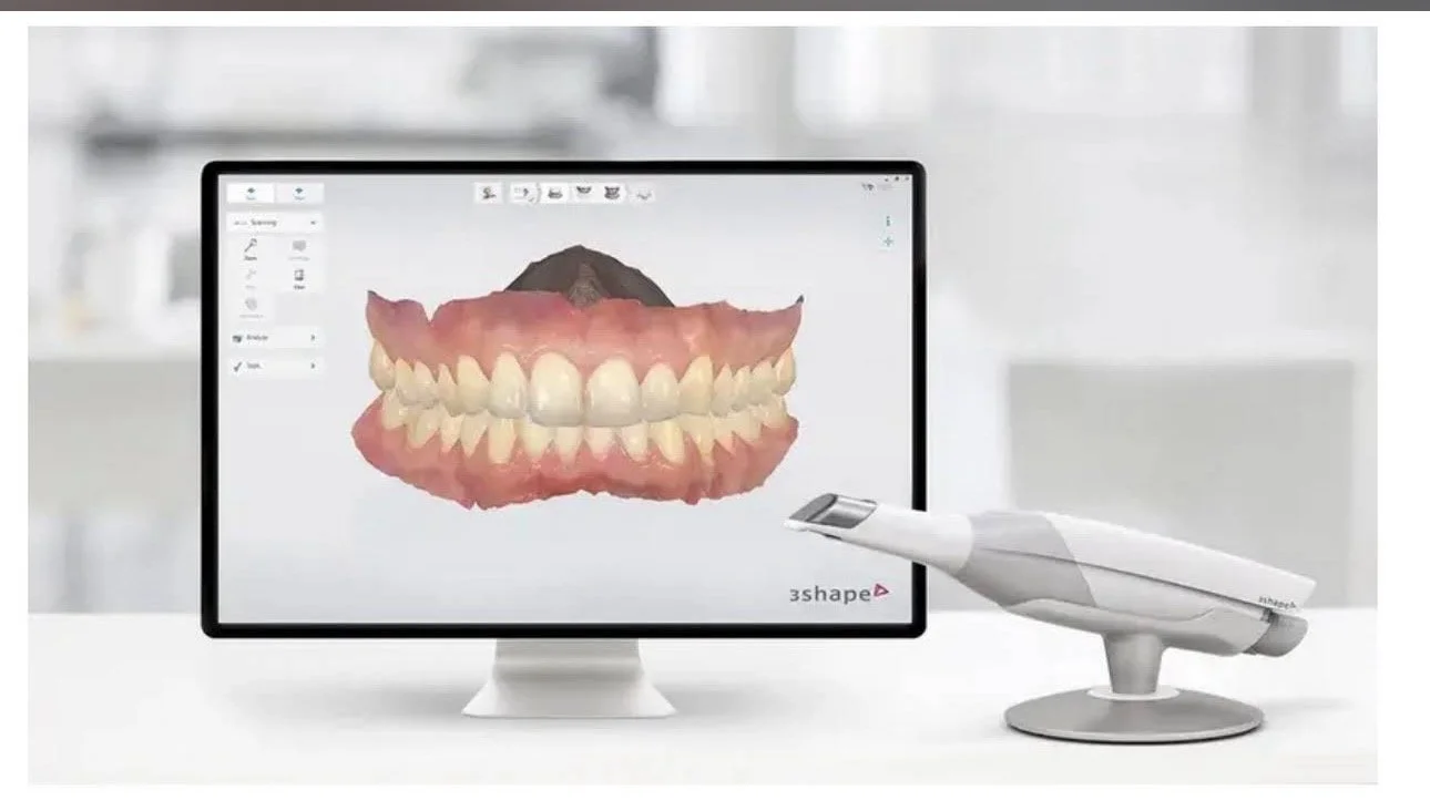 A computer monitor displaying a 3D digital model of teeth and gums with a dental scanning device on a white table in a dental office.