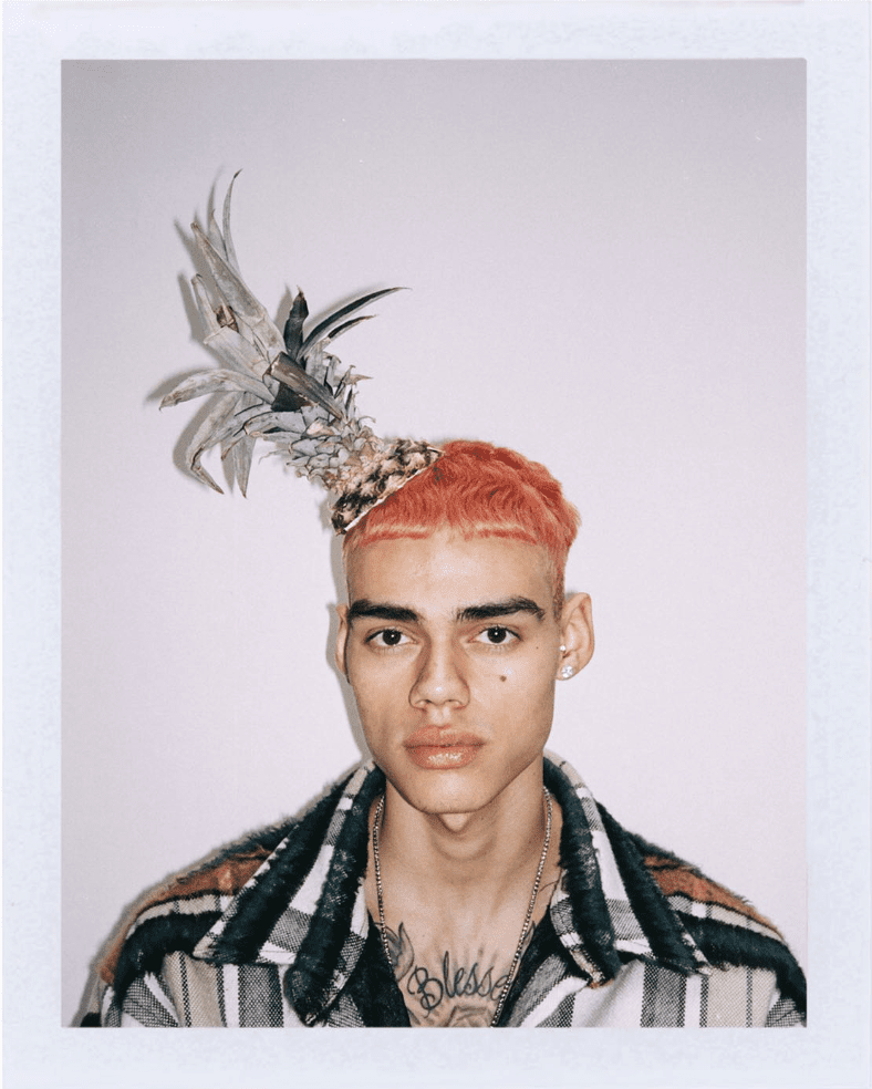 Young man with pink hair and tropical pineapple hat, wearing a striped shirt and earrings, standing against a plain background.
