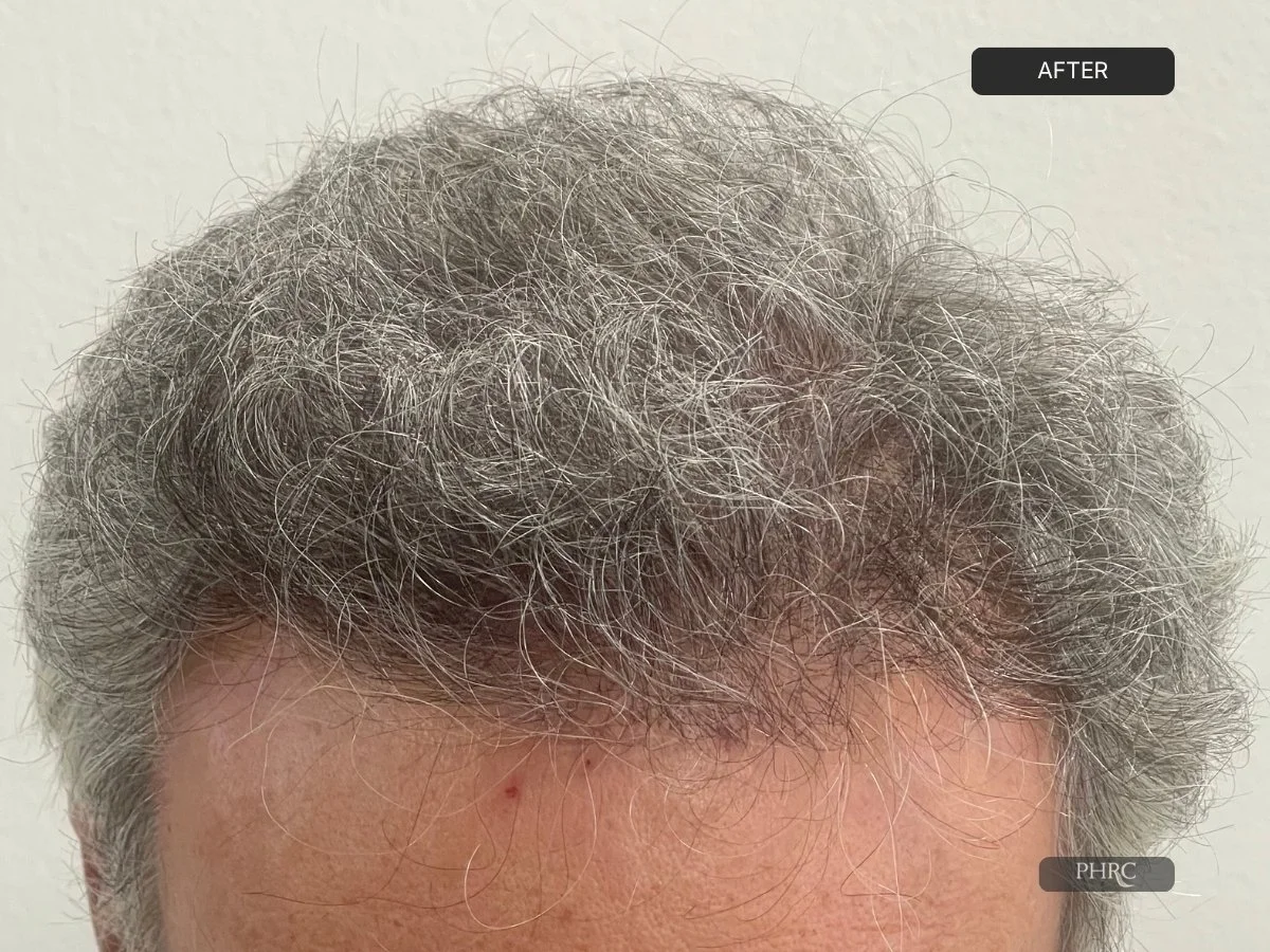 After Case 5.jpg