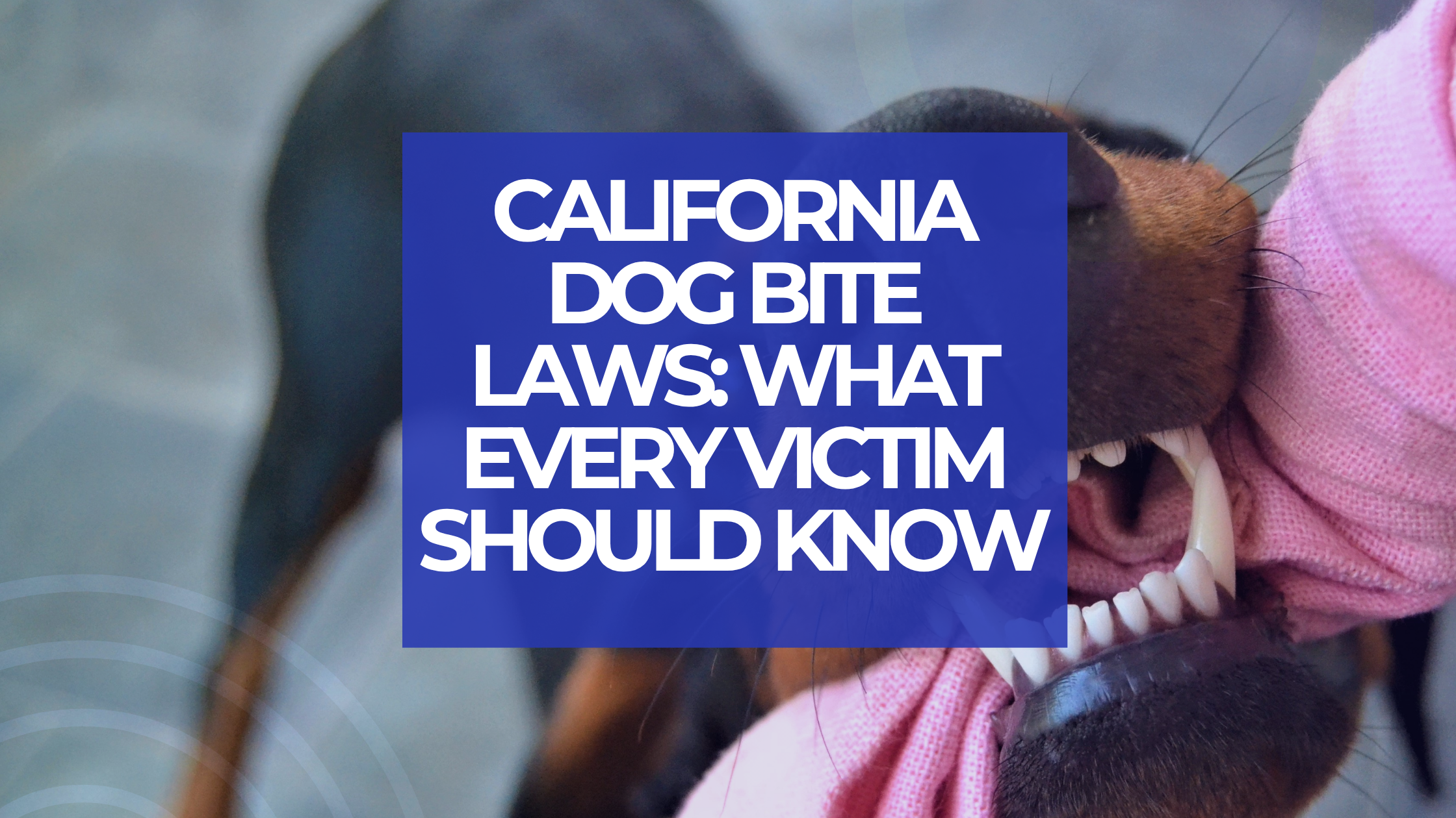 California Dog Bite Laws: What Every Victim Should Know