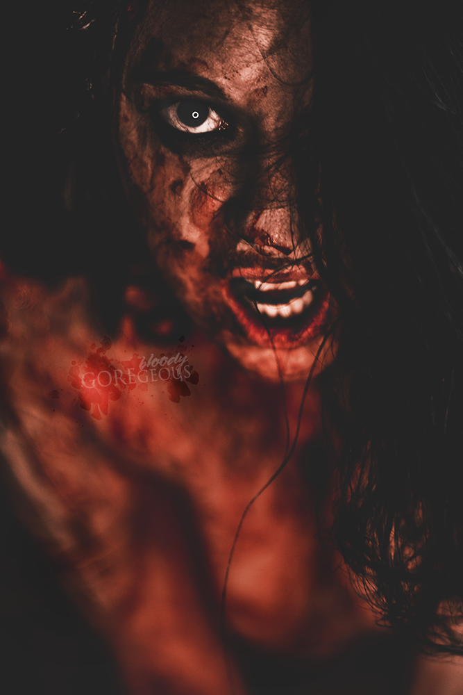 Bloodletting