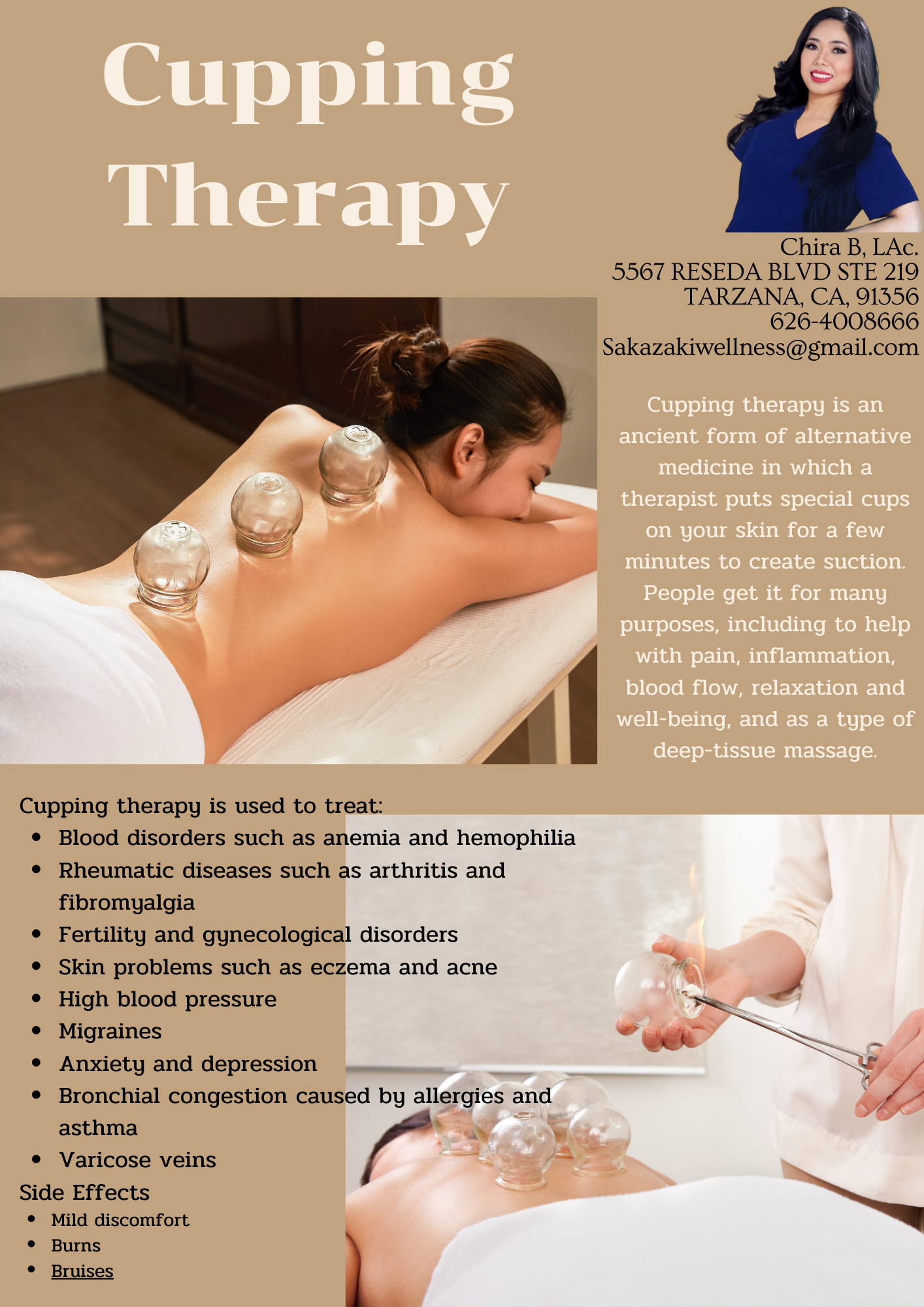 Cupping therapy for muscle tension and pain relief at Dr. Chira Wellness.