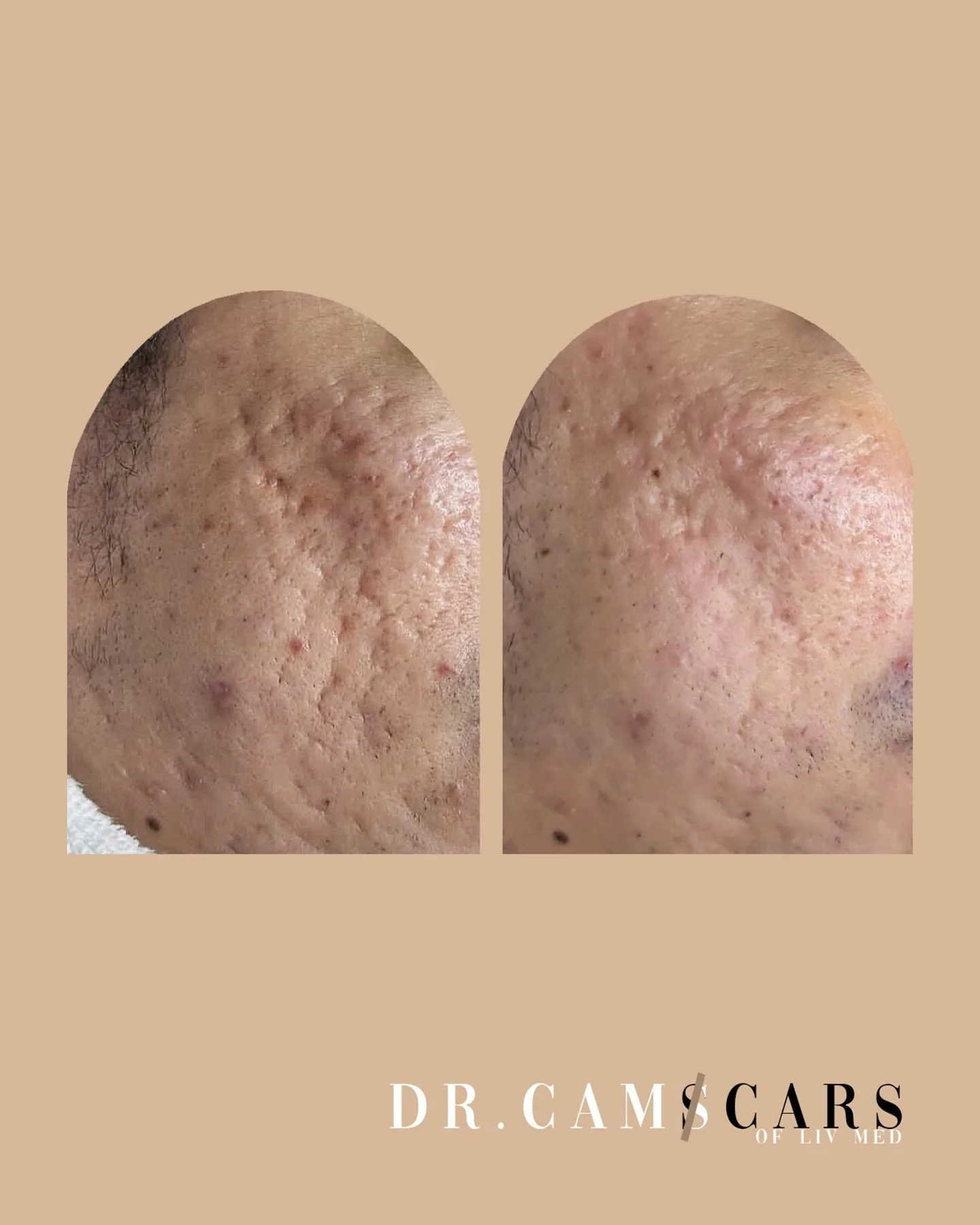 Client update: 1 session of trinity plus only!