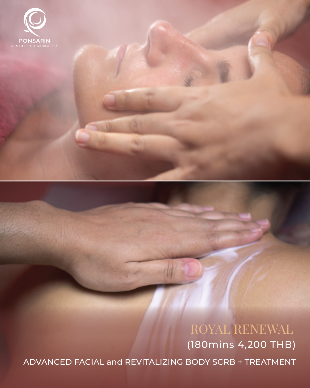 Royal Renewal Package