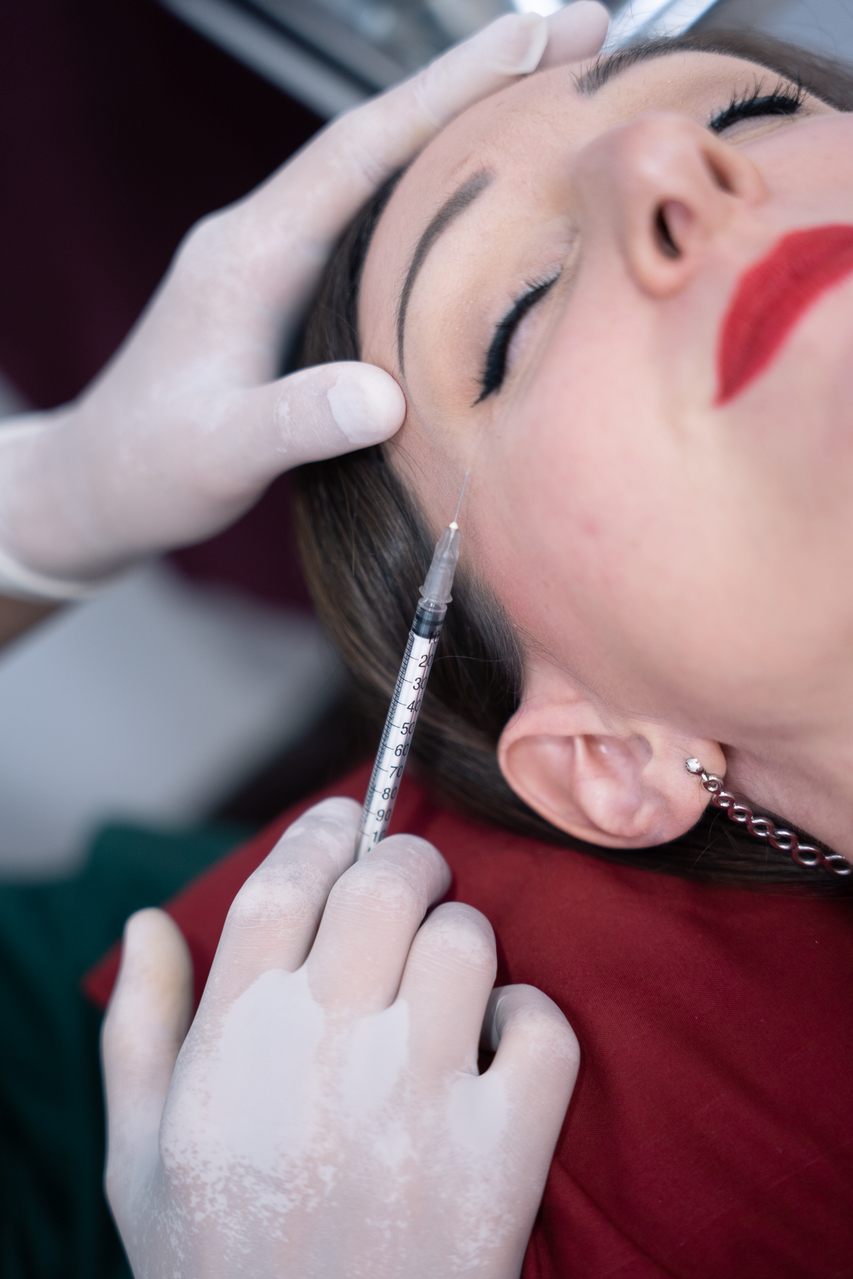 "Ponsarin Clinic doctor administering a botox injection near a client's crowfeet."