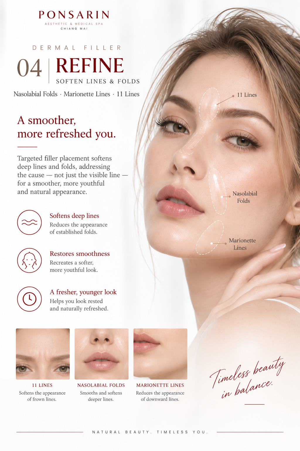 Dermal filler treatment areas for nasolabial folds, marionette lines and glabellar lines at Ponsarin Clinic Chiang Mai.