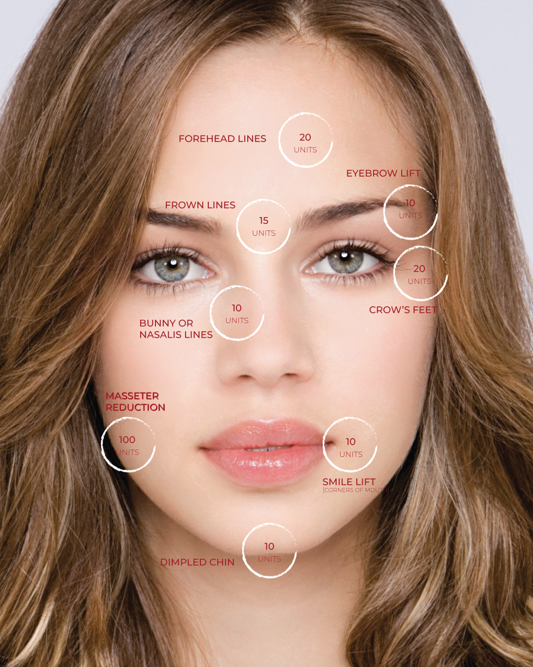“Ponsarin clinic botox injection dose diagram showing treatment areas on a woman's face, including forehead lines, frown lines, crow's feet, and masseter reduction, with unit dosages marked.”