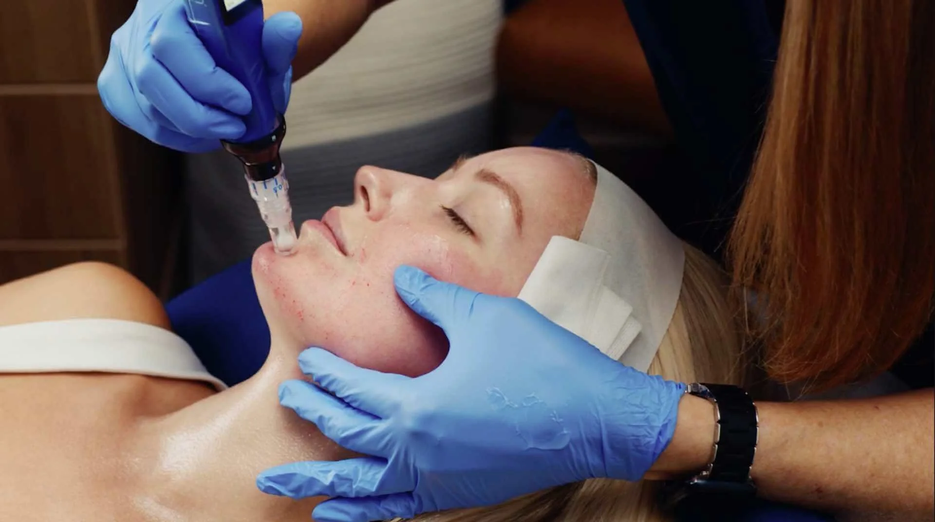 SkinPen® Precision Microneedling