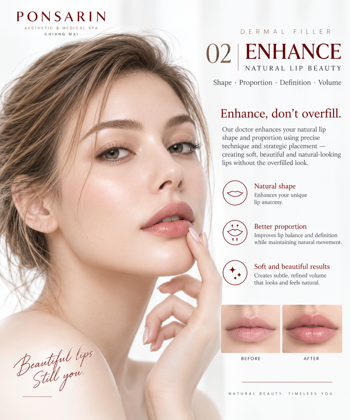 Natural lip filler enhancement focusing on shape, proportion, definition and subtle volume at Ponsarin Clinic Chiang Mai.