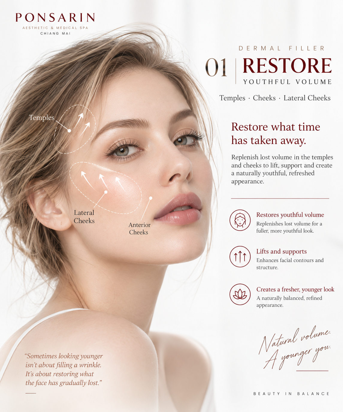 Dermal filler treatment areas for restoring youthful facial volume in the temples, anterior cheeks and lateral cheeks at Ponsarin Clinic Chiang Mai.