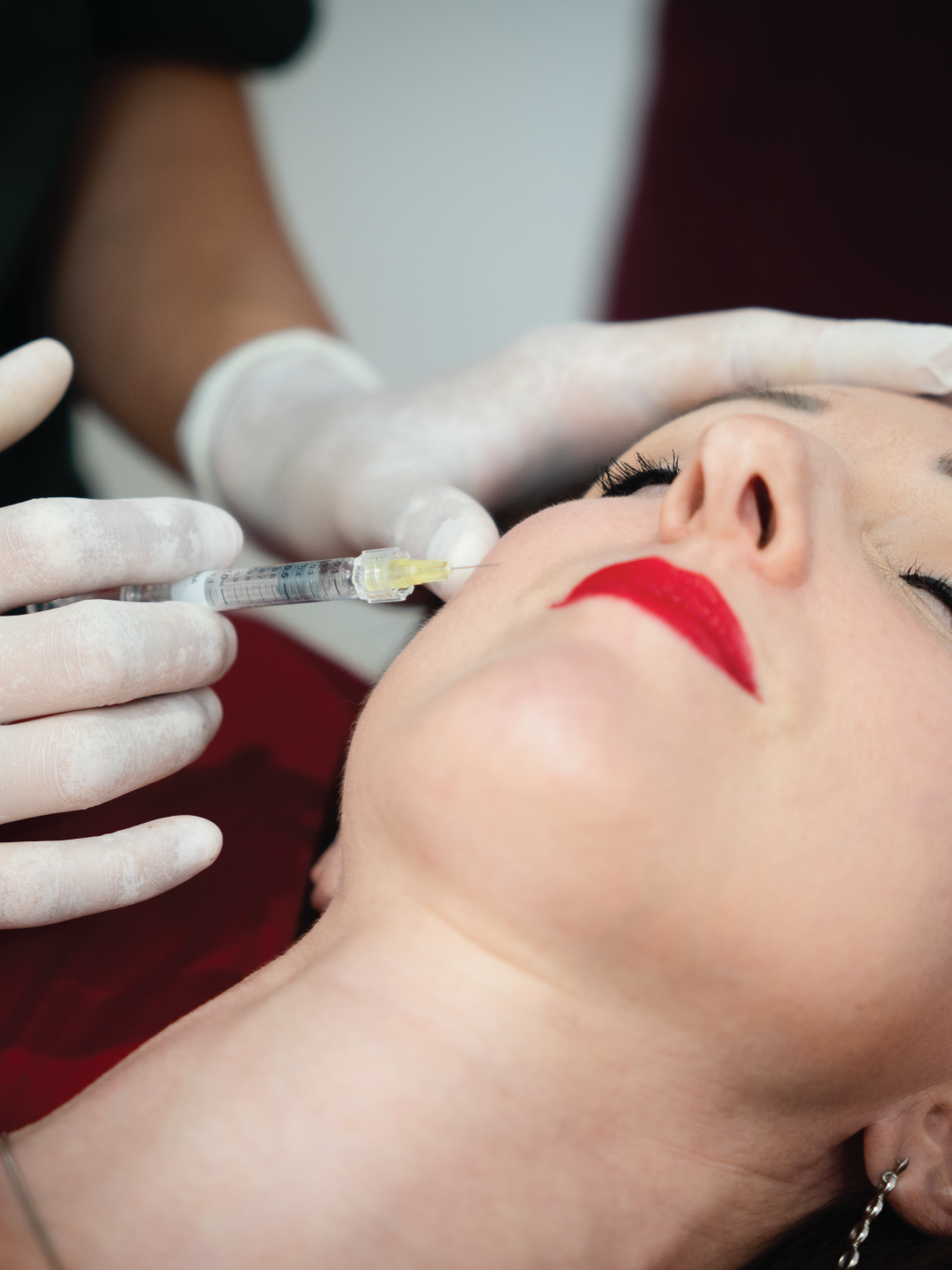 "Close-up of Dr. Sawami administering a filler injection near a client's lip area at Ponsarin Clinic."