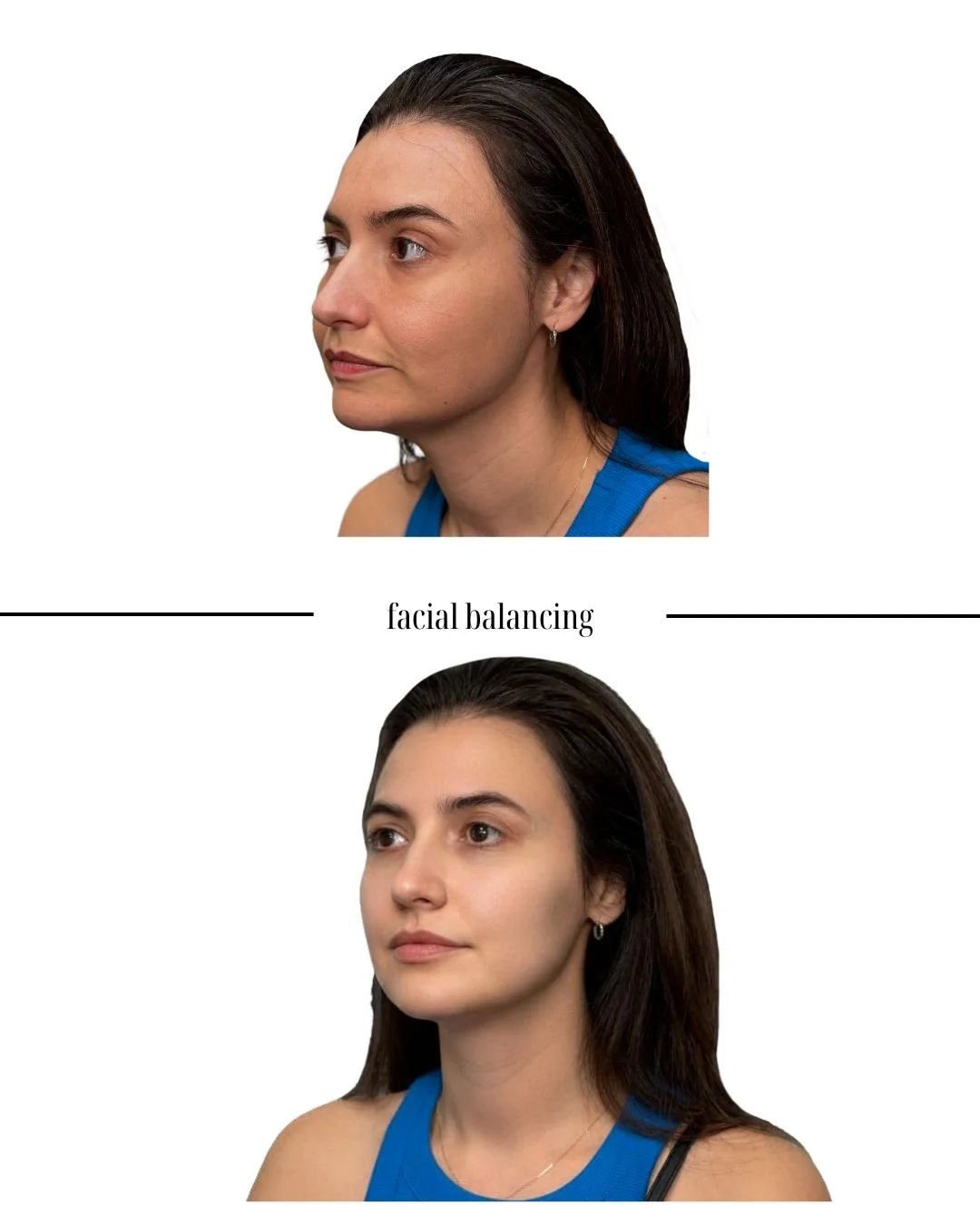 Before and after images of a woman demonstrating facial balancing, with the text 'facial balancing' between the photos