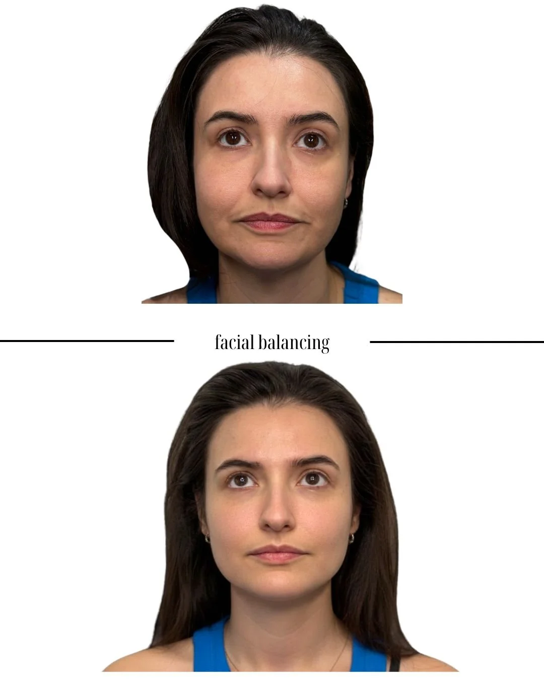 Comparison images of two women demonstrating facial balancing, with the top woman having asymmetrical features and the bottom woman showing more symmetrical facial features.