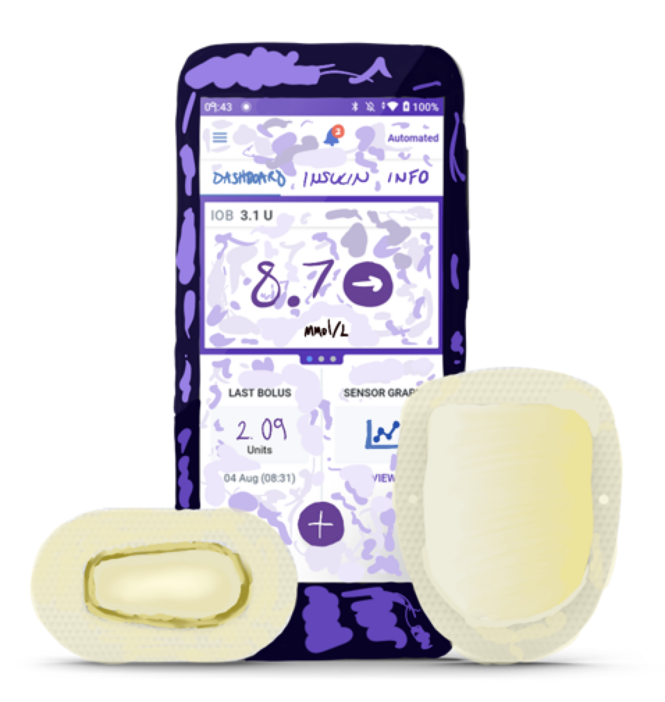 Illustration of purple device displaying a blood glucose reading of 8.7 and is accompanied by a sensor and pod to be placed on the skin of a Type 1 Diabetic.