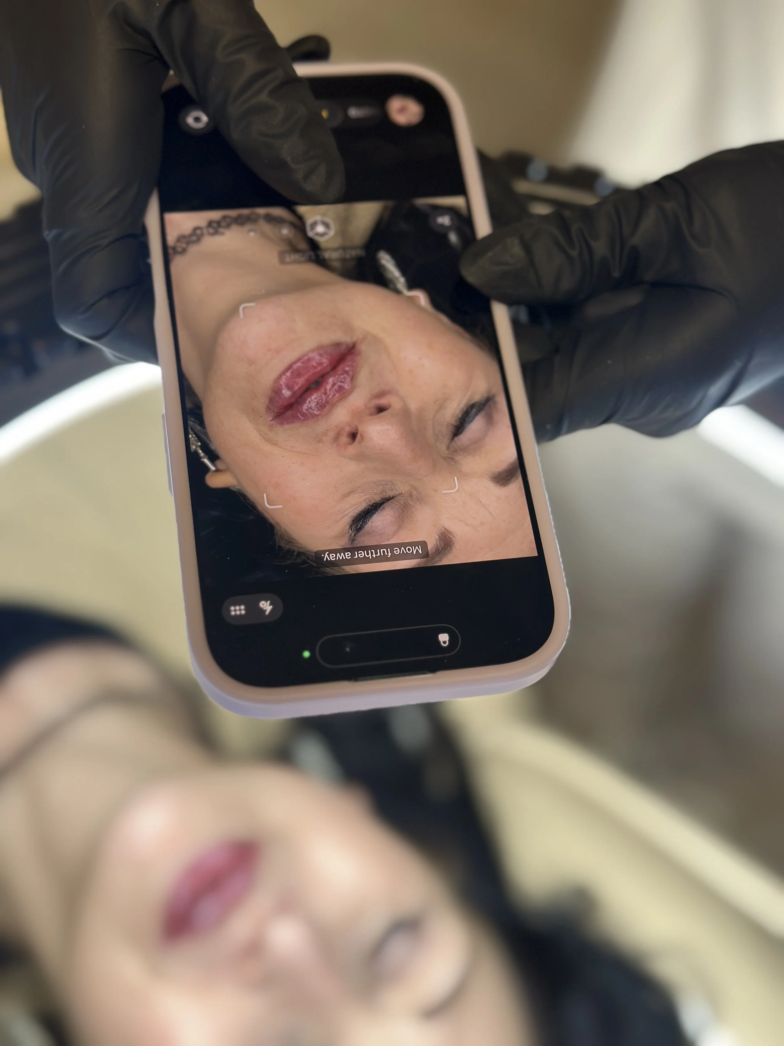 Lip Filler Portsmouth
