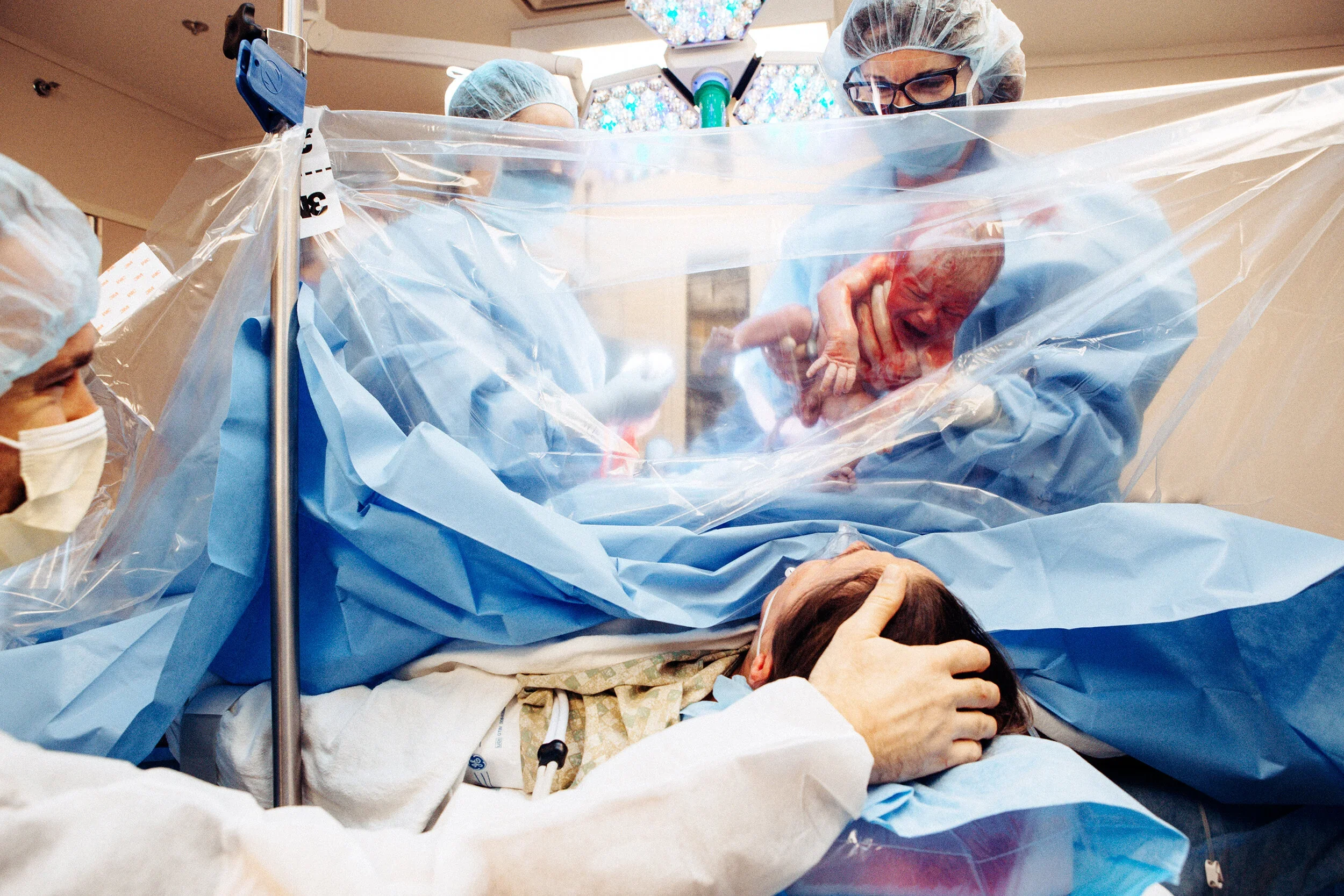 Medical team performing childbirth delivery in an operating room, with a newborn baby being handed over to a woman lying on a hospital bed.