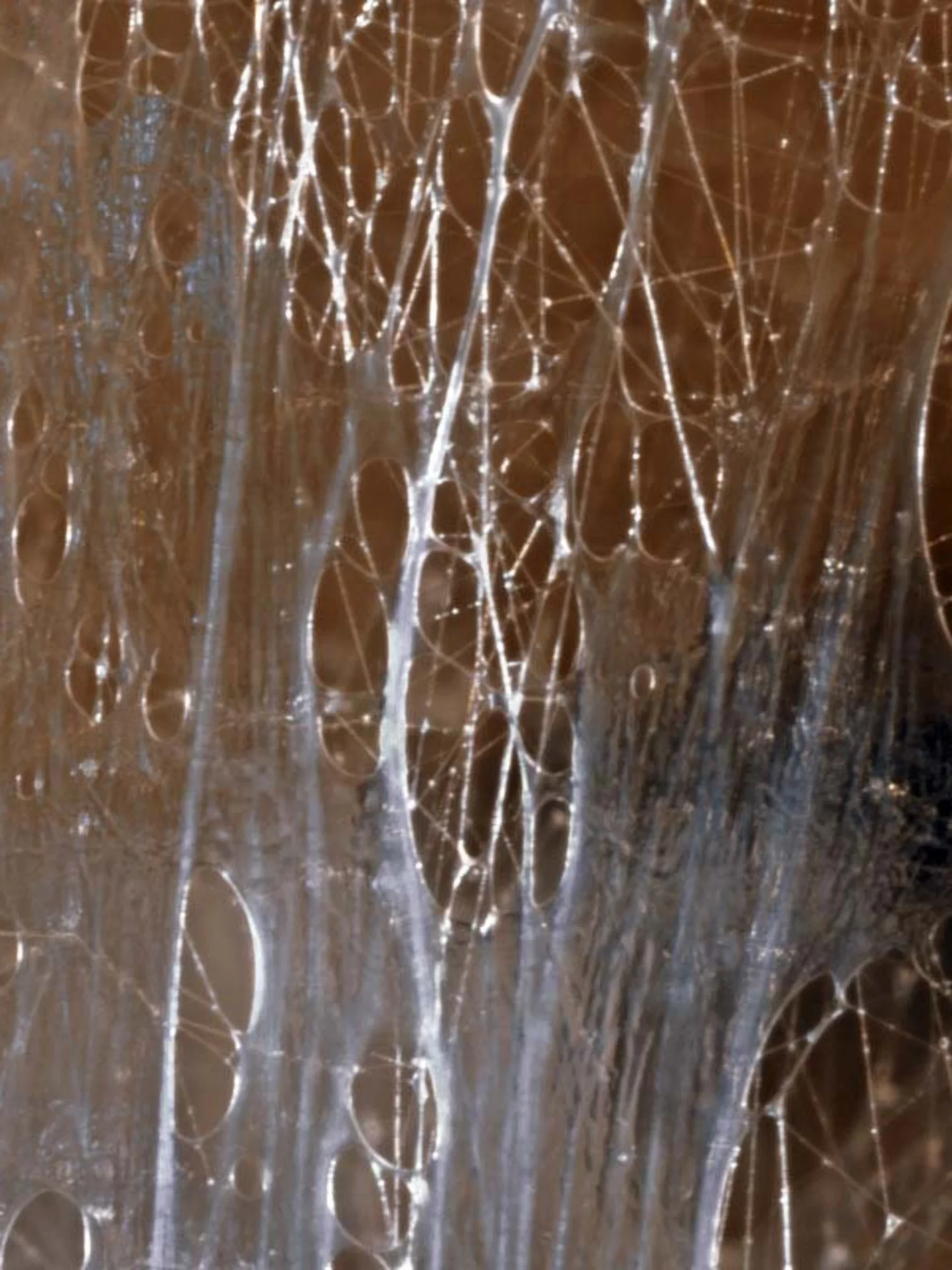Close-up of fascial tissue