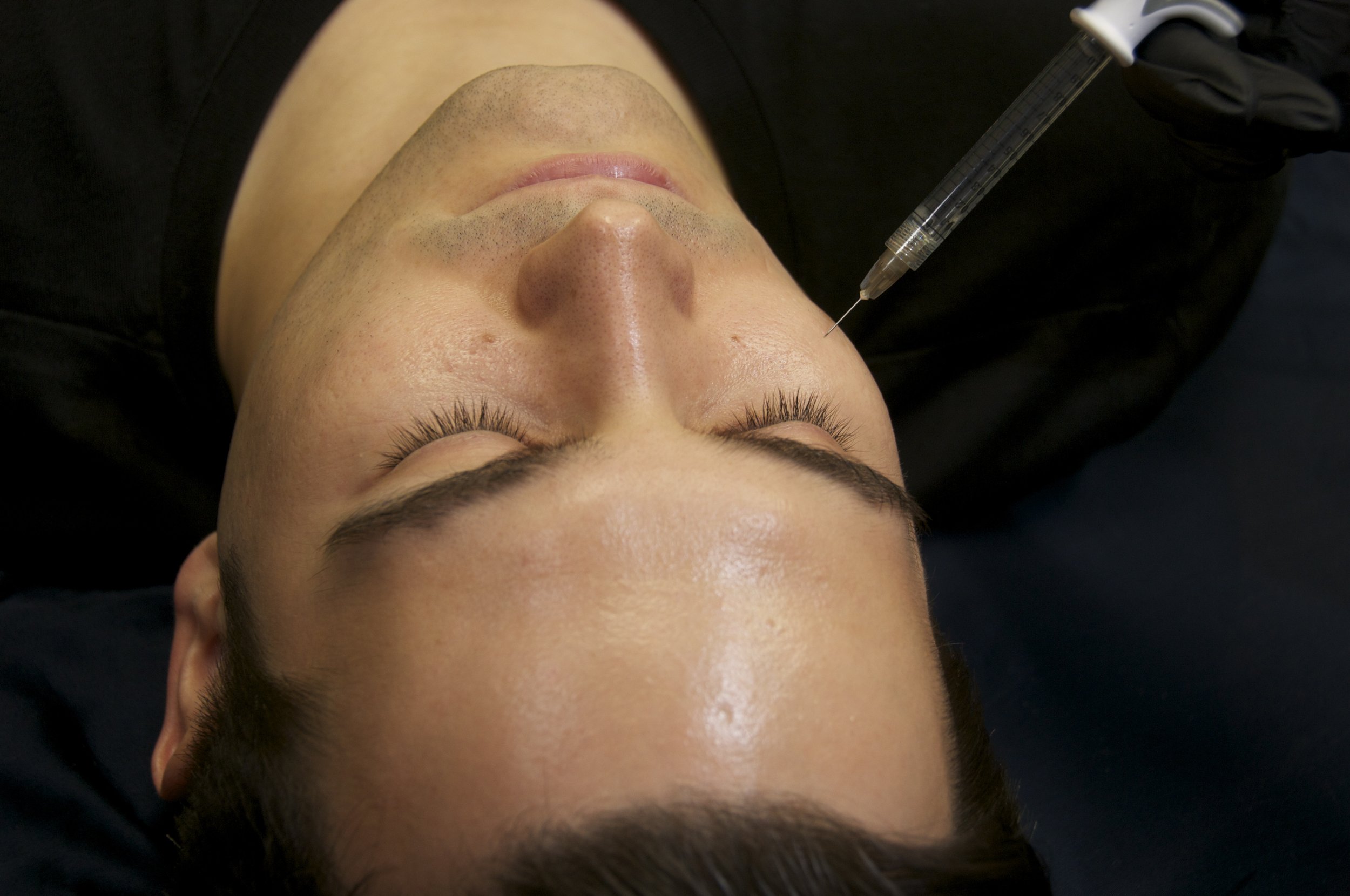 Book your dermal filler consultation