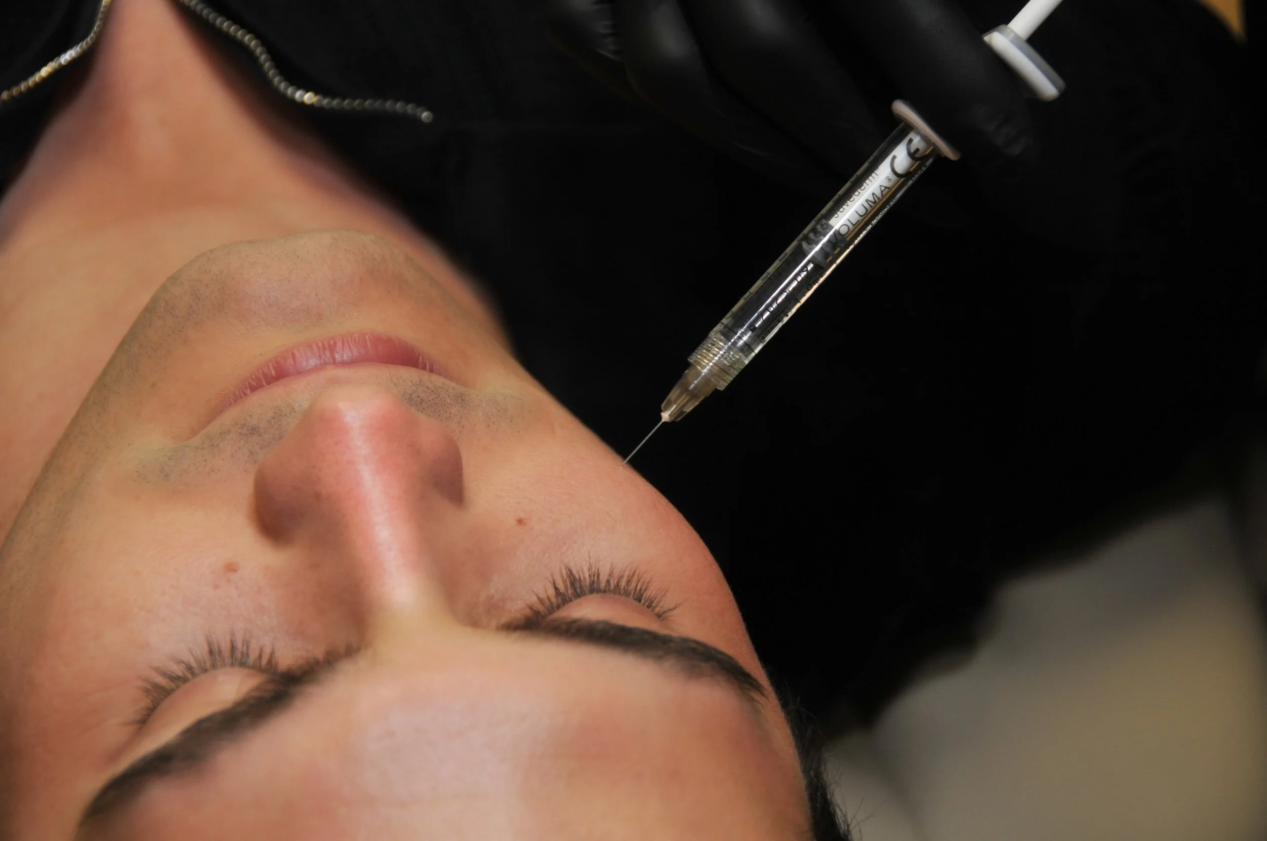 Dermal Fillers London