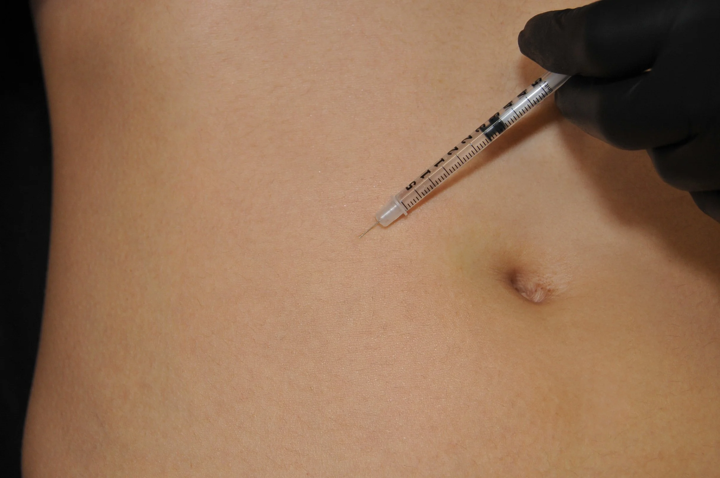 Body Contouring