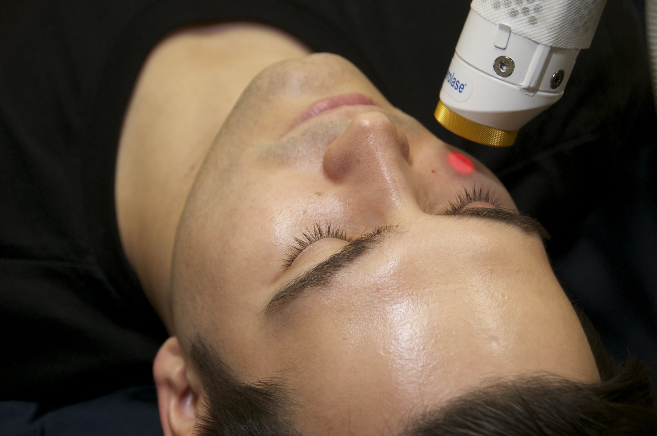 Aerolase Laser Therapy