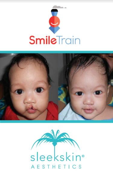 Give a Smile!