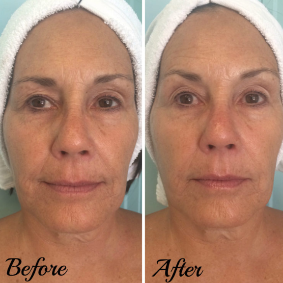 Customer Highlight: Molly S.